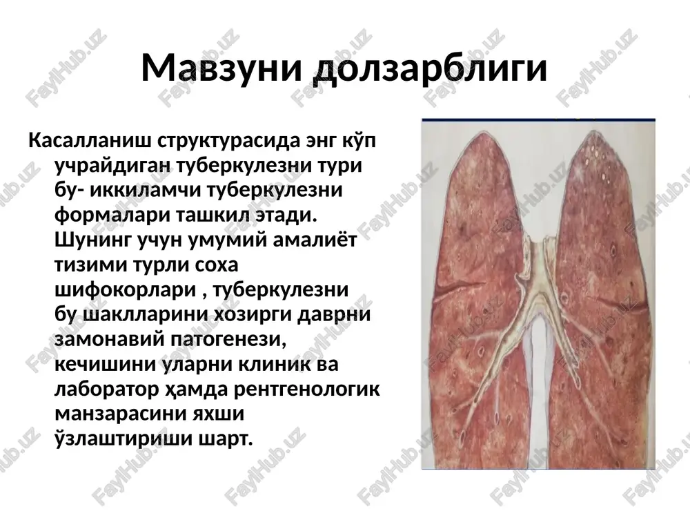 . 2. organizmda birlamchi sil infektsiyasi rivojlangan davrda o'pka cho'qqilarida tarqalish o'choqlari paydo bo'ladi, ular asta-sekin fibroz qobiqqa o'raladi, to'liq petrifikatsiyalanadi, bu simon o'choqlari deyiladi. yuqoridagi o'choqlarda smb saqlanib turadi. ma'lum sharoit tug'ilganda bu shakllar smbning bakterial shakliga qayta aylanadi hamda eski o'choqlarning avjlanishiga va o'choqli sil rivojlanishiga sabab bo'lishi mumkin. 3. aniqlanmagan ѐki to'la-to'kis davolanmagan ko'krak ichi limfa tugunlari silida, limfa tugunlarida faol sil jaraѐni saqlanib turgan bo'lsa, smb gemotogen ѐki limfogen yo'l bilan o'pkaga tushadi. bunda gemotogen tarqalish o'pka cho'qqilarida, limfobronxogen tarqalish, asosan, o'rta va pastki bo'laklarda o'choqlar paydo bo'lishiga olib keladi. ko'krak ichi limfa tugunlari yirik bronxlar sili bilan asoratlangan bo'lsa, bunday o'choqlar ko'plab hosil bo'ladi. 4. o'z vaqtida aniqlanmagan, yashirin kechadigan, zo'rayib boruvchi o'pkadan boshqa a'zolar silidagi o'choqlardan smb gemotogen yo'l bilan o'pkani zararlaydi. 5. o'choqli sil boshqa o'pka sili turlarining oqibati bo'lishi mumkin. yallig'langan, kavakli, tarqoq o'pka sili turlarining asliga qaytishidan, kapsulaga o'ralgan, noto'liq ѐki …