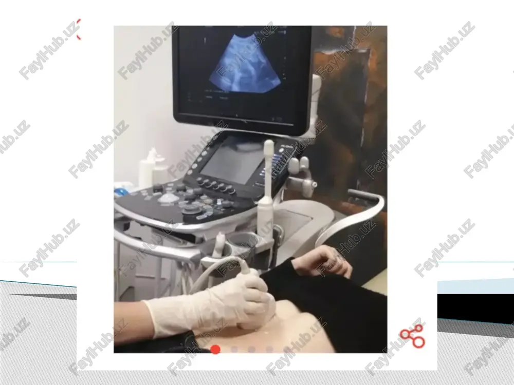dan oshmaydi. har kuni o'tkaziladigan muolajaning davomiyligi 10-15 minut, bir kurs davoga 8-12 muolaja. zaruriyat tug'ilganda ultra tovush terapiya 2-3 oydan keyin qayta qo'llaniladi. bu usul yordamida organizmga dori modda-lari kirgizilishi mumkin, bu usul fonoforez yoki ultrafonoforez deb ataladi. masalan : butadion,gidrokartizon, dolgit va boshqa dorili mazlar. bu muolaja davolash amaliyotida juda keng qo'llaniladi, ayniqsa hozirda keng tarqalgan bo'g'im kasalliklarida. davolovchi samarasi:ultratovush terapiyaning potentsiyalashgan samarasi va ultratovush bilan kirgizilayotgan dori moddasining maxsus samarasi. ko'rsatma. kirgizilayotgan dori moddasining farmakologik samarasini hisobga olish bilan aniqlanadi va ultratovush terapiya uchun ko'rsatmalar. qarshi ko'rsatmalar. ultratovush terapiya uchun qarshi ko'rsatmalarga o'xshash, ularga kirgizilayotgan dori moddalarining allergik reaktsiyasi taalluqli. image1.jpeg image2.jpeg image3.jpeg image4.jpeg