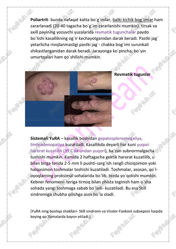 nosteroid yallig`lanishga qarshi preparatlar, immuosupressorlar, immunomodulyatorlar, kortikosteroidlar, analgetiklar buyuriladi. nomedikamentoz davo. - rejim - badantarbiya - ortopedik korreksiya oqibatlari -amiloidoz -makrofaglar faollashuv sindromi - o`sishdan orqada qolish - infeksion (bakterial sepsis) - yurak-o`pka yetishmovchiligi foydalanilgan adabiyotlar: 1. “detskie bolezni” n. p. shabalov, 2002 2. “pediatriya po nelsonu” berman, kligman, djenson, tom iii, 2009 3. internet ma'lumotlari