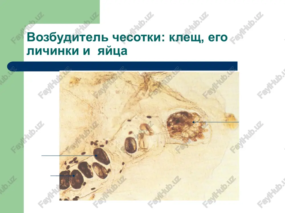 chesotka (scabies) - Page 3
