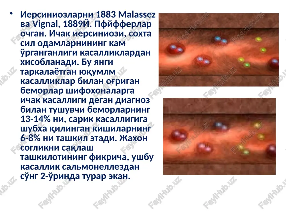 am kasallik belgilarning turli tumanligi bilan ajralib turadi. kasallikning yashirin davri 2-6 kun, ayrim xollarida 19-22 kungacha bo'ladi. kasallikning boshlanish davri 6-8 soatdan 2-3 kungacha boradi. beiorlarda bexollik, bosh og'rig'i, qaltrash kuzatiladi. ayrim paytda yuqori nafas yo'llarining yalig'lanishiga xos belgilar kuzatiladi, suyaklardi, mushaklarda, bo'g'imlar og'riq paydo bo'ladi, ko'ngil aynishi, qorin og'rixam kuzatiladi. xarorat 38-39* ga etadi istmalash 1-26 kungacha davom etishi mumkin. kasalikning 1-4 kungacha toshma toshishi mumkiin va 2-3 kun saqlanib turadi. kasallikning rivojlanish davrida linfa tugunlari xam kattalashadi ko'pchilik bolalarda xarorat tayanch sistemasi xam zararlanadi. jigar kattalashadi, nerv sistemasi, qon tomir yurak sistemalari zararlanadi. bolalarning ichi 4-8 marttagacham suyuq keladi. ichak iersiniozida yashirin daviir 1-2 kundan 6 sutkagacha bo'ladi. klinik kechishi turli tuman bo'ladi. eng ko'p uchraydigan turi enterokolit (ingichka va yo'g'on ichakning yallig'lanishi) krrinda kuchli og'riq pydo bo'ladi, xarorati 37,5 - 39* gacha ko'tariladi, bosh og'rishi, ko'ngil aenishi, qaltirash kuzatiladi. terisi oqarib, shilliq pardalar ko'karadi, 8-12 soatda …
