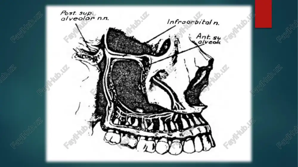 slik uchun ignaning to'qimaga kiritilishi zahoti anestetikni yuborish. qon tomirlarga igna tushganligini tekshirish maqsadida shprits porshenini orqaga tortib ko'rish, qon chiqsa ignaning holatini o'zgartirish lozim. anesteziya qilib bo'lganidan so'ng kaft bilan lunjni siqib ushlab turish qontalash oldini oladi. tanglay katta teshigida o'tkaziladigan anesteziya. uch shoxli nervni ikkinchi shohidan qanot-tanglay chuqurchasida hosil bo'lgan qanot-tanglay tugunidan ajralib tanglay nervi katta tanglay kanali orqali katta tanglay teshigidan chiqadi va tanglay shilliq pardasining orqa qismini innervatsiya qiladi. bajarish texnikasi ignani sanchishdan oldin tanglay katta teshigining joylashishini tasavvur qilish kerak. teshik proyeksiyasini topish uchun hayolan ikkita bir birini kesib o'tuvchi chiziq o'tkazamiz, biri uchinchi katta oziq tishi o'rtasidan tanglay parallel chokigacha. shu masofa uchga bo'linadi va alveolyar o'siq tomondan masofaning 1/3 qismi mo'ljalida ikkinchi kesib o'tuvchi chiziq o'tkaziladi. shu chiziqlar kesishgan nuqta katta tanglay teshigi proyeksiyasi bo'ladi. ogiz ochib turganda bu teshikka ignani perpyondikulyar sanchib bo'lmaydi. igna qiyalab borishini e’tiborga olib, u teshik proyeksiyasidan 0,5 …
