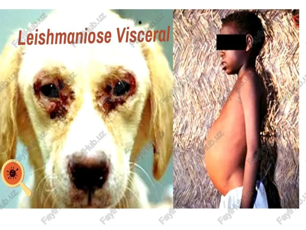 leshmanioz teri va vissral shakli tekshirish usullari - Page 3