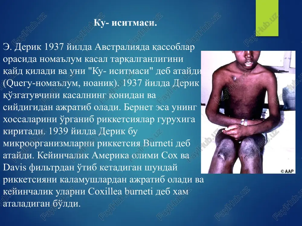 ng qolgan immunitet mustaxkam bo'lib, uzoq saqlanadi. xayvonlarda kasallik surunkali o'tadi. laboratoriya diagnostikasi. kasallnkning 2-xaftasidan bernet rikketsiyasi antigeni bilan agglyutinatsiya reaktsiyasi qo'yiladi. reaktsiyaning musbat titri 1:10-1:16 nisbatiga teng bo'ladi. kasallikning 3-5 xaftasida titr mx darajada bo'ladi. reaktsiya dinamikada ko'yiladi. kbr- spetsifik bernet antigeni bilan qo'yiladi. spetsifik allergik sinama xam qo'yish mumkin. davosi. asosan keng ta'sir doirasiga ega bulgan antibiotiklar ishlatiladi.bunda tetratsiklin, streptomitsin, roksibel va boshkalar kullaniladi. profilaktikasi. molxonalarni, ayniksa ularni tugish vaktida sistematik dezinfektsiya kilish, sutni kaynatib iste'mol kilish, kasalni darxol kasalxonaga yotkizish, kasallik yukori bulgan joylarda bernet rikketsiyasidan tayyorlangan vaktsina bilan emlash ishlari keng kulamda olib boriladi. etiboringiz uchun raxmat! image3.jpeg image4.jpeg image5.jpeg image6.png image7.jpeg image8.jpeg image9.jpeg image10.jpeg image11.jpeg image12.jpeg image13.jpeg image14.jpeg image15.jpeg image16.jpeg image1.jpeg transm jon among ticks transmission among vertebrates ‘© transovarial © trans-stadial © aerial © direct contact transmission between ticks and vertebrates © tick bite nymphs © tick feces coxiella burnetii (q fever) trans among …