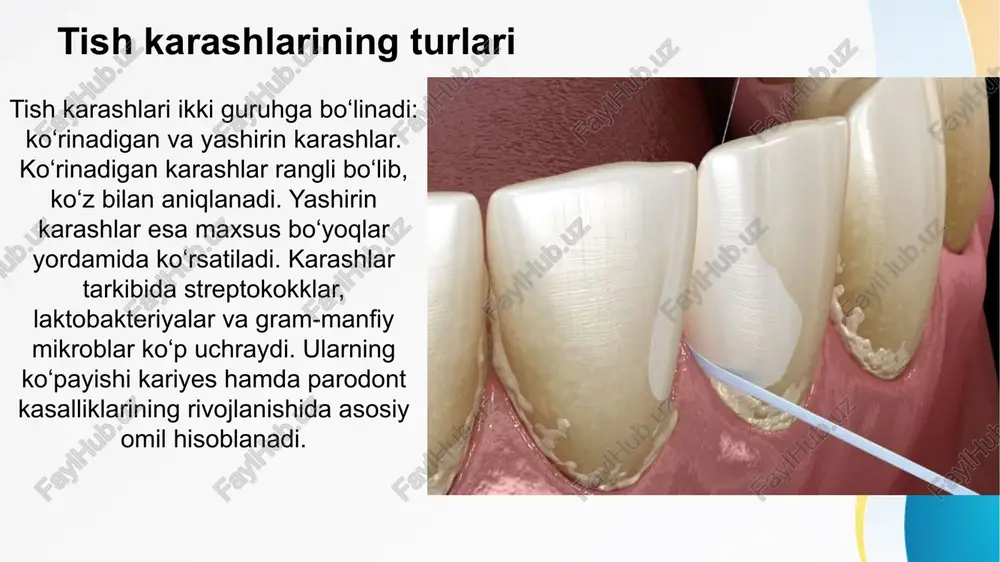 h kechiksa tishlarni yo‘qotishga olib keladi. gingivit gingivit — parodont kasalliklarining dastlabki bosqichi bo‘lib, gingivaning yallig‘lanishi bilan xarakterlanadi. uning sabablari karash, noto‘g‘ri gigiyena, gormonal o‘zgarishlar va immunitetning pasayishi hisoblanadi. belgilari — gingiva qizarishi, shishishi, cho‘tkalashda qonashidir. o‘z vaqtida davolanmasa, gingivit parodontitga o‘tishi mumkin. parodontit parodontit gingiva yallig‘lanishi alveolyar suyak va parodontal ligamentlarga tarqalishi bilan kechadi. kasallikda cho‘ntaklar hosil bo‘ladi, suyak rezorbsiyasi boshlanadi. bemorlar tish qimirlamasi, og‘riq va yomon hiddan shikoyat qiladi. parodontit surunkali kechib, davolanmasa tishlarning to‘liq yo‘qotilishiga olib kelishi mumkin. parodont kasalliklari tasnifi parodont kasalliklari uch asosiy guruhga bo‘linadi: gingivit, parodontit va parodontoz. gingivit — faqat gingiva darajasida yallig‘lanish; parodontit — yallig‘lanish alveolyar suyak va ligamentlarni qamrab oladi; parodontoz — degenerativ, distrofik jarayon bo‘lib, yallig‘lanish belgilari kam uchraydi. bu tasnif klinik tashxis qo‘yishda asosiy ahamiyatga ega. e’tiboringiz uchun rahmat image1.jpeg image3.jpeg image4.jpeg image5.jpeg image6.jpeg image7.jpeg image8.jpeg image9.jpeg image10.png image11.png image12.jpeg image13.jpeg image2.jpeg dental plaque healthy tooth | diseased tooth …