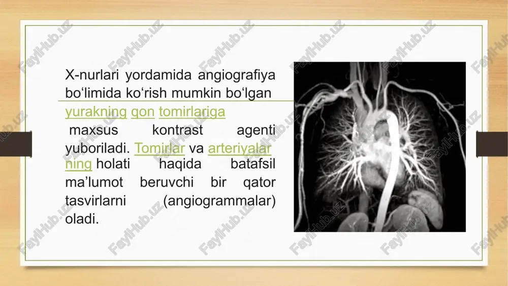 koronarangiografiya - Page 3