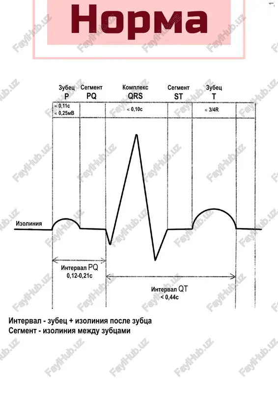 v kajdom komplekse, qrs vipadaet s opredelennoy chastotoy. chastota vipadeniy 2:1,3:1 ili 4:1. iii stepen - predserdiya i jeludochki sokrashayutsya v raznom ritme. zubtsi p i qrs ne svyazani drug s drugom. - chss 40-60 v minutu. - mogut vstrechatsya slivnie kompleksi. in st ag ra m .co m /m ed st ag ra m _1 vipadeniepostepennoe uvelichenie int-la pq vipadenie vipadeniepostoyanniy interval pq vozbujdenie predserdiy jeludochkoviy kompleks smotrim na kompleks qrs i osobenno na zubets q, na segment st. obrashaem vnimanie na otvedeniya, chtobi opredelit lokalizatsiyu. stadii: 1. ostreyshaya – ot momenta vozniknoveniya ishemii do nachala formirovaniya nekroza. 2. ostraya – formirovanie ochaga nekroza. do 7 sutok. 3. podostraya – polnoe zameshenie nekroticheskix mass granulyatsionnoy tkanyu, sootvetstvuet vremeni formirovaniya soedenitelnotkannogo rubtsa na meste ochaga nekroza. do 28 sutok. 4. rubtsevanie – formirovanie rubtsa v ochage nekroza. cherez 4 nedeli posle razvitiya im do kontsa jizni. pri vozniknovenii im chast …