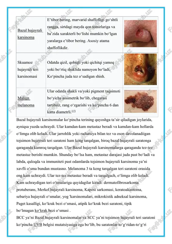 ujayrali karsinoma) , tojsimon hujayrali teri saratoni (tojsimon hujayrali karsinoma) va melanoma . saraton tavsif tasvir bazal hujayrali karsinoma eʼtibor bering, marvarid shaffofligi goʻshtli rangga, sirtdagi mayda qon tomirlariga va baʼzida xarakterli boʻlishi mumkin boʻlgan yaralarga eʼtibor bering. asosiy atama shaffoflikdir. skuamoz hujayrali teri karsinomasi odatda qizil, qobiqli yoki qichitqi yamoq yoki boʻrtiq shaklida namoyon boʻladi. koʻpincha juda tez oʻsadigan shish. malign melanoma ular odatda shakli va/yoki pigment taqsimoti boʻyicha assimetrik boʻlib, chegarasi tartibsiz, rang oʻzgarishi va koʻpincha 6 dan katta diametrli.[17] bazal hujayrali karsinomalar koʻpincha terining quyoshga taʼsir qiladigan joylarida, ayniqsa yuzda uchraydi. ular kamdan-kam metastaz beradi va kamdan-kam hollarda oʻlimga olib keladi. ular jarrohlik yoki radiatsiya bilan tez va oson davolanadiigan tojsimon hujayrali teri saratoni ham keng tarqalgan, biroq bazal hujayrali saratonga qaraganda kamroq tarqalgan. ular bazal hujayrali karsinomalarga qaraganda tez-tez metastaz berishi mumkin. shunday boʻlsa ham, metastaz darajasi juda past boʻladi va labda, quloqda va immuniteti past …