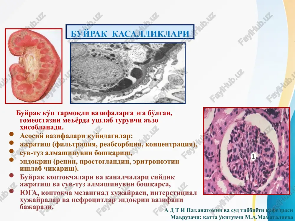 omuruloskleroz), xomiladorlik nefropatiyasi. iv. buyrakning kimyoviy, fizik va b. ekzogen omillardan zararlanishi natijasida paydo buladigan kasalliklar (dorilarga alokador, toksik, nefropatik) va b. u. turli sabablarga kura boshlanadigan utkir buyrak etishmovchiligi (tugri kelmaydigan kon kuyilgandan keyin, septik abortda, tashrixdan keyin va b.). vi. boshka kasalliklar bilan birga davom etadigan buyrak kasalliklari (2-nefropatiyalar, endokrin, metabolik nefropatiyalar va b.). vii. buyrak tosh kasalligi. viii.buyrak usmalari. a d t i pat.anatomiya va sud tibbiyoti kafedrasi ma'ruzachi: katta o'qituvchi m.a.mamatalieva buyrak anomaliyalari ( s, l, v va takasimon kurinishlari) siydik nayi anomaliyalari (juft nay, nayni retrokoval joylashuvi) a d t i pat.anatomiya va sud tibbiyoti kafedrasi ma'ruzachi: katta o'qituvchi m.a.mamatalieva buyrakning aplaziyasi buyrakni distopiyasi variantlari buyrak polikistozlari kanalchalarni rivojlanish nuksonlari. makroskopik kistalar yupka devorli atrofiyalangan bir kavatli kubsimon epiteliy bilan koplangan, ichidan tinik suyuklik saklaydi. kuprok bunday kistalar buyrakning pustlok katlamida uchraydi. a d t i pat.anatomiya va sud tibbiyoti kafedrasi ma'ruzachi: katta o'qituvchi m.a.mamatalieva …
