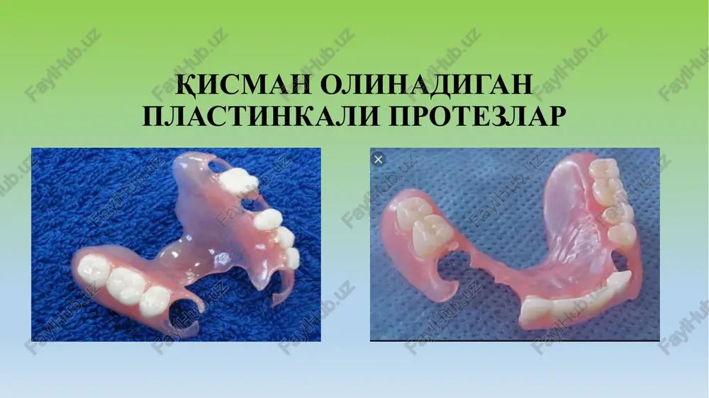 kuchli atrofiyasi tishlarning tez ishqalanishi og'iz bo'shlig'ining kichik dahlizi chekka nuqsonlar 15 image1.png image2.png image3.png image4.png image5.png image6.png image7.jpeg image8.png image9.png image10.png image11.png image12.jpeg image13.jpeg image14.jpeg image15.jpeg print /docprops/thumbnail.jpeg