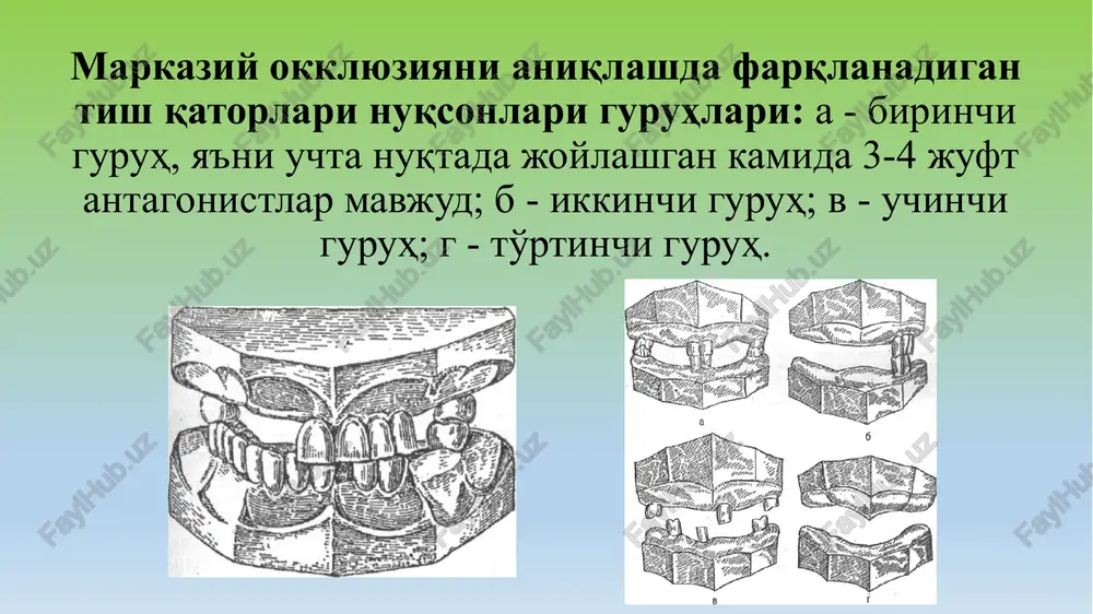 atomik iz olish. sabablari: shifokorning nazariy tayyorgarligi pastligi, qolip olish texnikasi noto'g'riligi va mos bo'lmagan qolip olish materialidan foydalanish. xatoni tuzatish: yangi nusxalar olish. jag'larning markaziy nisbatini aniqlashdagi xatolar yoki bu bosqichni o'tkazib yuborish ular tishlarning noto'g'ri qo'yilishiga olib keladi. sabablari: jag'larning markaziy nisbatini aniqlash texnikasini bilmaslik. xatoni bartaraf etish: jag'larning markaziy nisbatini qayta aniqlash yoki protez konstruktsiyasini tekshirish bosqichida xatoni tuzatish. protez konstruktsiyasini tekshirishdagi xatolar. bu bosqichda oldingi bosqichlarda yo'l qo'yilgan xatolarni o'tkazib yubormaslik uchun rejaga qat'iy rioya qilish kerak. karkasni tekshirishda, agar u elastik bo'lib chiqsa, nusxalarni qayta olish va karkasni qayta yasash kerak. protez qo'yishdagi xatolar: deontologik yondashuvning yo'qligi: • davolashning tugallanganligi tamoyiliga rioya qilmaslik • shifokor tomonidan aseptika va antiseptika qoidalariga rioya qilmaslik xatolarni bartaraf etish: shifokor shuni yodda tutishi kerakki, davolash protez qo'yish bilan tugamaydi, hali moslashish davri bor. bemor protezga to'liq moslashgandan keyingina davolash yakunlangan hisoblanadi. shifokor bemorga protezdan foydalanish, og'iz bo'shlig'i gigienasi haqida …