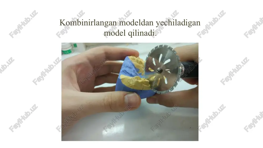 olinmaydigan tishprotezlari bilan protezlash - Page 3