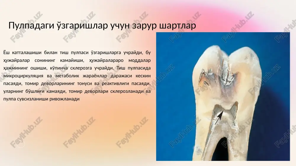 anali ingichka bo'ladi, lekin sezilarli bo'ladi va pulpa kamerasi ko'rinadi. to'liq obliteratsiya-pulpa kamerasi va kanali shu darajada minerallashganki, ular endi ko'rinmaydi. periapikal suyakning shikastlanish belgilari bo'lmasa, qattiq plastinka periodont tolalari maydonini kengaytirmasdan saqlanib qoladi. 10 pulpa toshlarining gistopatologiyasi odatda uch turga bo'linadi pulpadagi erkin toshlar odatda pulpa to'qimalarida uchraydi. toshlarning kattaligi diametri 50 mikrondan bir necha millimetrgacha o'zgarishi mumkin va butun pulpa kamerasini to'ldirishi mumkin. biriktirilgan pulpa toshlari pulpa bo'shlig'ining devoriga biriktirilgan, ammo dentin bilan to'liq qoplanmagan. o'rnatilgan pulpa toshlari dentinga to'liq singib ketgan va ko'pincha ildizning apikal qismida joylashgan. 11 diagnostika konkrematoz pulpitning muhim diagnostik belgisi-bunday tishning perkussiyaga zaif og'riqli reaktsiyasi. shu munosabat bilan ma'lum sog'lom tish bilan qiyosiy perkussiyani o'tkazish maqsadga muvofiqdir. bu har bir bemorni klinik tekshirish paytida amalga oshirildi. barcha bemorlarda shpritsdan sovuq va issiq suv bilan sug'orish orqali termodiagnostika paytida protezlar aniqlangan tish pulpasi haroratning kichik o'zgarishiga javob bermadi, termometriya og'riq keltirmadi. bu tishlarning eod …