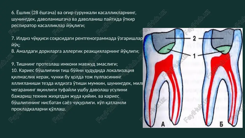 odont) reocap (vivadent) kaltsesil (vladmiva) 10 kaltsiy gidroksid saqlovchi nurda qotuvchi polimerlar calcimol lc (voco) ultra-blend (ultradent) kaltsesil lc (vladmiva) 11 evgenolni o'z ichiga olgan pastalar ham odontotrop va yallig'lanishga qarshi ta'sirga ega. evgenol-saqlovchi pastalar: biodent; tsink-evgenolli pasta (pulpani to'g'ridan-to'g'ri qoplash uchun mo'ljallanmagan); cavitec (firma kegg); eugespad (firma spad). 12 boshqa dorivor pastalardan foydalanish mumkin ex tempore va boshqa dorilar: • yog bazasi bilan aralashtirilgan gidroksiapatit kukuni (evgenol, a vitamini moyi eritmasi, shaftoli yog'i va boshqalar.); kalmetsin poroshoki, 10— 20% li dimeksidning eritmasida aralashtirilgan; shu bilan birga, kalmetsinning rn qiymati pasayadi va dimeksid yaqqol yallig'lanishga qarshi ta'sirga ega bo'ladi; 13 • lizotsim-vitaminli pasta (vitamin aning yog'li eritmasiga lizotsimning bir nechta kristallari va rux oksidi pasta konsistentsiyasiga ega bo'lguniga qadar qo'shiladi); 14 vajnoe napominanie pulpitni davolashning biologik usuli bilan davolangan barcha bemorlar apikal periodontitning asemptomatik rivojlanishining oldini olish uchun dispanserda ro'yxatga olinishi kerak. eod 1, 6, 12 oydan keyin amalga oshiriladi. …