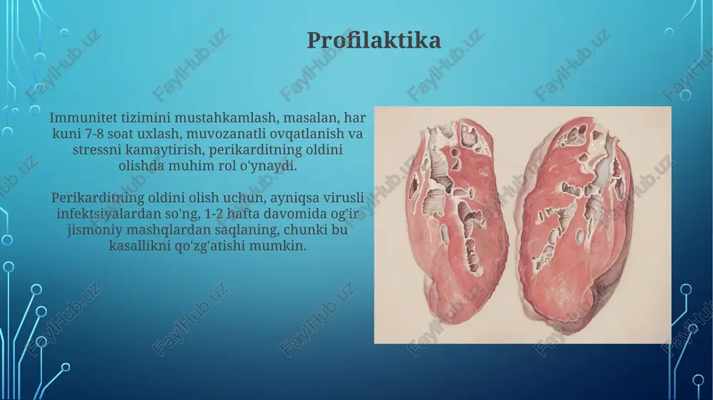 ilishi va pr segmentining depressiyasini ko'rsatishi mumkin, ammo bu o'zgarishlar har doim ham mavjud emas va kasallikning bosqichiga bog'liq. ta'rif va epidemiologiya perikardit - yurakni o'rab turuvchi ikki qavatli qopning yallig'lanishi bo'lib, ko'pincha virusli infeksiyalar, ba'zan esa bakterial yoki zamburug'li sabablar bilan bog'liq bo'ladi. surunkali perikarditda, ayniqsa konstriktiv perikarditda, etiologiyasi tuberkulyoz va boshqa sistemali yallig'lanish kasalliklari 30 foizgacha bo'lishi mumkin. e'tiboringiz uchun rahmat image3.png image4.jpg image5.jpg image6.jpg image7.jpg image8.jpg image9.jpg image10.jpg image11.jpg image12.jpg image13.jpg image14.jpg image1.png