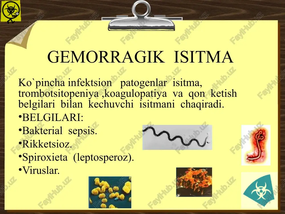 nqiragan yuz ,qovoq shishi (yuqorigi qovoqda mayda qon quyilish) oliguriya ,ba`zan anuriya mikroo yoki makro gematuriya giperazotimiya bsgi ehtimolli holat quyidagi holatlarga shubha qilinganda. kasallikkacha 6 hafta davomida kemiruvchilar virus tashuvchilar, kasallangan odam va hayvonlar yashaydigan regionlarda bemorning bo`lganligi. mos keluvchi holatlar bsgi shubxa qilingan hollarda mos keluvchi vam quyidagilardan minemal birtasi. glps epidemiologik bog’liqlik tasdiqlanadi. bsgi tasdiqlovchi holatlar quyidagilardan minemal birtasi. ifa usulida tekshirganda igm va igg antitelolarining topilishi real vaqt rejimida ishlovchilarda ptsr musbat bo`lishi qon yoki siydikda virusning topilishi immunigistoximik metodda patologanotomik materialda antigen aniqlaninshi. bsgi klinik belgilari yuz giperemiyasi va shishi bsgi klinik belgisi kechki davrda yuzda rangparlik va shishinqirashi. terida papullez gemorragik toshma. bsgi klinik belgisi. til quruq va giperemiyasi. bsgi klinik belgisi. jgut bog’langan joyda gemorragiyalarning bo’lishi (vazopatiya xisobiga). bsgi klinik belgisi. petixial va katta gemorragiyalar bsgi klinik belgisi. toshma elementlarining ko`rinishi bsgi klinik belgisi. in`ektsiya qilingan joyda nuqtali gemorragik toshma va gematoma bsgi …