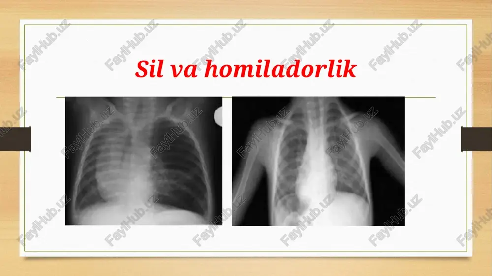 sil va homiladorlik - Page 3