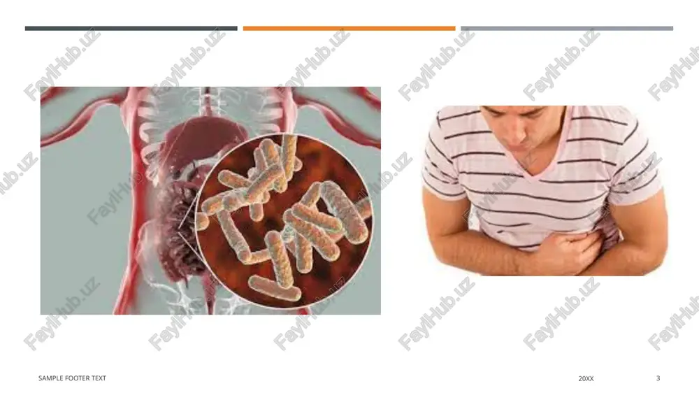 ʻgʻon ichagi yalligʻlanganda ichi ketadi, keyinchalik ichi qotadi. kasallik ogʻir oʻtganda hayvon nobud boʻladi. davolash: ichni yumshatuvchi dorilar (natriy va magniy sulfat), antibiotiklar va boshqalar beriladi. ichaklarni dezinfeksiyalovchi dorilar ichiriladi. image1.jpeg image2.jpeg image3.jpeg image4.jpeg image5.jpeg image6.jpeg