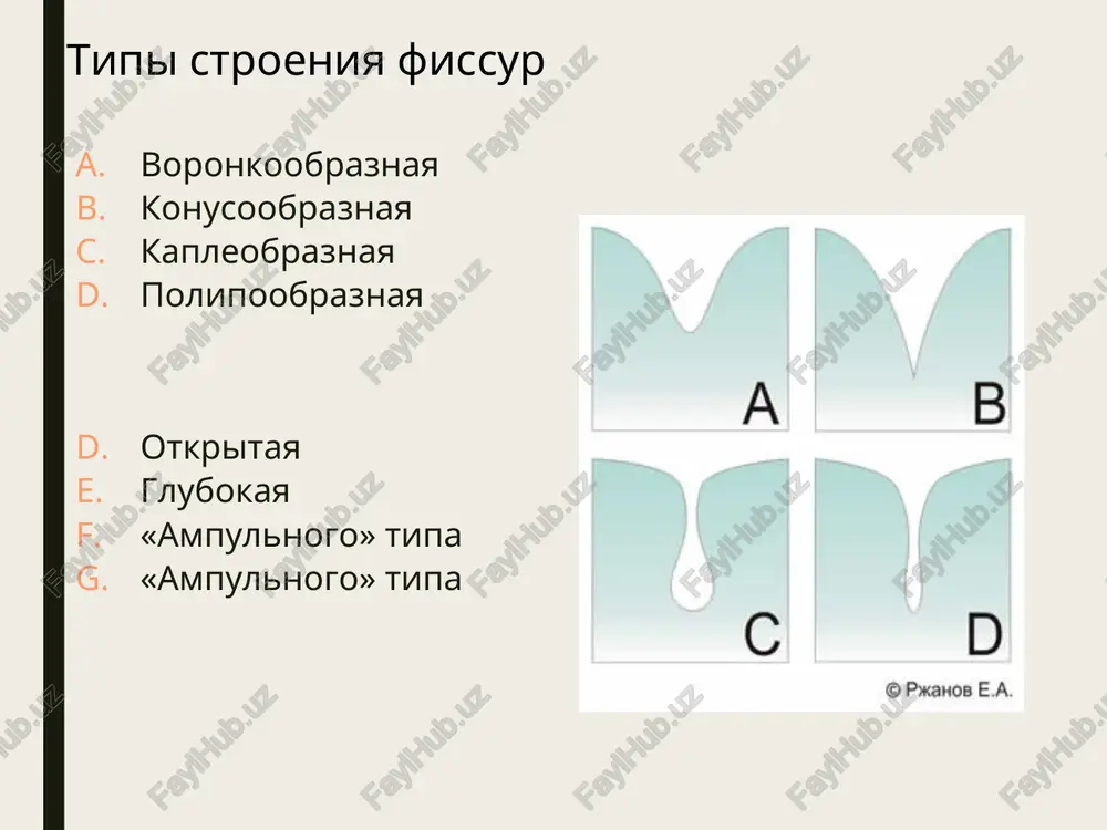 limerizatsiyalanuvchi yoki kimyoviy kotuvchi: «concise white sealant» (3m, usa), «delton» (johnson and johnson), «delton», «fis sil» (rossiya) fotopolimerizatsiyalanuvchi: «estisial lc» (kulrer), «sealant» (bisco), «fissurit», «fissurit f» (voco), «delton-s», «fis sil-s» (rossiya) germetizatsiyalovchi materiallar germetizatsiya metodlari noinvaziv invaziv e'tiboringiz uchun raxmat !