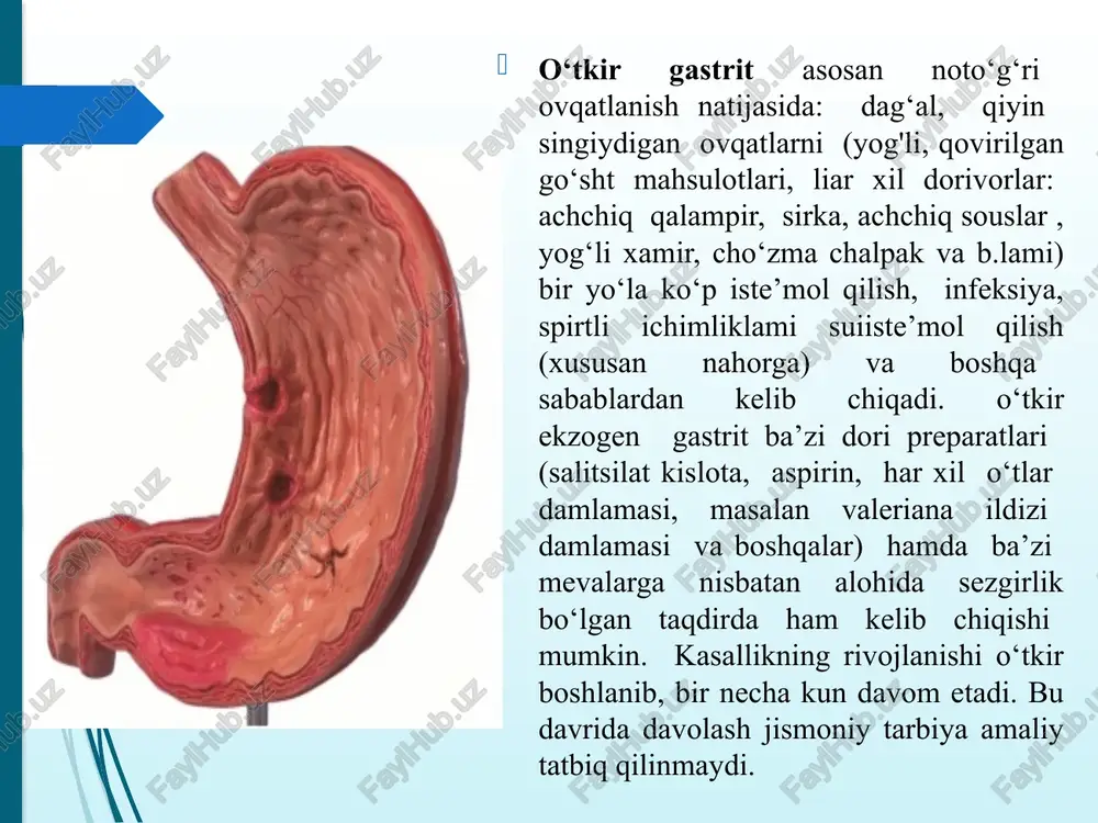bilan kasal bo‘lgan. ayniqsa, sekretor funksiyasi pasayganlarida, o‘ta jismoniy yuklamalar berish tavsiya etilmaydi. giperatsidli va gipoatsidli gastritlarda djt uslubi gipoatsid gastritda qo’llaniladigan mashqlar kompleksiga oyoq-qo‘l va tanani hamda qorin mushaklarini kuchaytiruvchi mashqlar, tizzani baland ko‘tarib yurish, umurtqa pog‘onasining harakatchanligini yaxshilovchi mashqlar kiritiladi. bemor suzish, eshkak eshish, konkida uchish va chang‘ida yurish, ekskursiyalarda qatnashish kabi mashqlar bilan shug‘ullanishi mumkin. kasalni xuruji pasaygan vaqtida ko‘proq samara beruvchi elementar gimnastik mashqlar sekin tempda harakat amplitudasi pasaygan - chegaralangan va dastlabki holat yotib bajariladi. qorin bo‘shlig‘iga faol mashqlar berish tavsiya etilmaydi. davolash gimnastikasi mashg‘ulotlari ovqatdan avval yoki ovqat yetilgandan so‘ng 2-2,5 soat o‘tgandan so‘ng beriladi. me’da va o‘n ikki barmoq ichakning yara kasalligi. kasallik kelib chiqishining asosiy sabablari-ovqatlanish tartibining buzilishi, tamaki va alkogolning ta’siri, nerv va emotsional ta’sirlanish, psixik jarohatlanish, qorin bo‘shlig‘ining har xil kasalliklari va boshqalardi.bu kasallikda bemorlar ko‘pincha har xil dispepsik holatlarga (jig‘ildon qaynash, kekirish, oshqozon yuqori qismidagi og‘riqlar, qusish, ko'ngil aynash) …