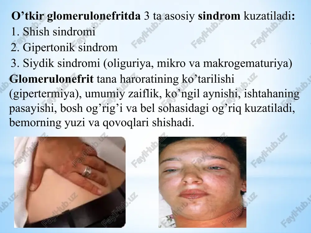 ) 28-29 ° c haroratda mashq bajarish: faol harakatlar snaryadlar bilan (qo'lning bo'g'imlarida harakatlarni rivojlantirish uchun zinapoya, vazni 0,5 kg og'irlikdagi gantell), gimnastika devorida; trenajorlar. mashqning sur'ati sekin yoki o'rtacha; takrorlanish soni - 12-14 marta (14-16 marta) dars davomiyligi - 35-40 daqiqa (40-45 daqiqa) artrit - bu yallig'lanish jarayoniga asoslangan bo'g'im, uning qobiqlariga va periartikulyar to'qimalarning sinovial membranasida lokalizatsiyalangan kasallik. djtning vazifalari: umumiy harakat oralig'ini normalgacha oshirish; zararlangan hududda mushaklarni, asosan yozuvchi guruhlarini mustahkamlash davolash jismoniy tarbiyasi uslubi: 1) davolash massaji, fizioterapiya 2) davolash gimnastikasi: dastlabki holat: elka kamari uchun - yotgan va o'tirgan, oyoq kamari uchun - yotgan ta'sirlangan bo'g'inlar uchun passiv harakatlar (mayda amplituda yumshoq tebranishlardan boshlab) kasal bo'g'im hududida mushaklarning bo'shashtirish (kasal oyoqning taranglashgan mushaklarining bo'shashishi sog'lom oyoq-qo'llar tomonidan faol harakatlarni amalga oshirishga yordam beradi) suvda (hovuzda, hammomda) 28-29 ° c haroratda mashq bajarish: faol harakatlar snaryadlar bilan (qo'lning bo'g'imlarida harakatlarni rivojlantirish uchun zinapoya, vazni 0,5 kg …