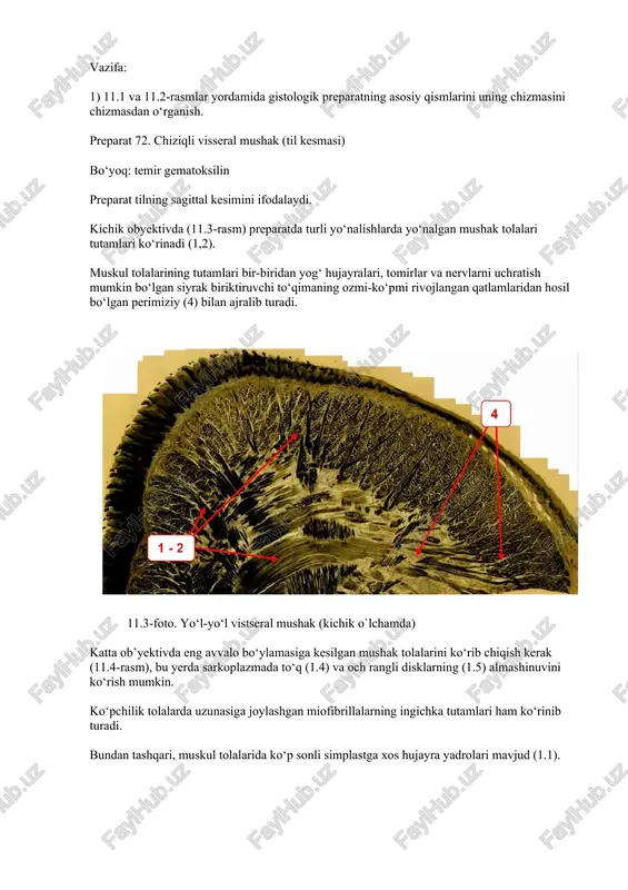 da gemokapillyarlar (gk) joylashgan. 11.5-foto. chiziqli vistseral mushakning ko‘ndalang kesimi (kattalashtirish) vazifa: 1) mashg‘ulot bayonnomasini albomda tuzish; 2) 11.3-rasm yordamida chiziqli visseral mushak to‘qimasining umumiy tuzilishini tasavvur qiling; 3) 11.4 va 11.5 fotosuratlar yordamida bayonnomada belgilar ro‘yxatiga muvofiq xarakterli mato elementlarini chizish va imzolash. preparat 73. yurakning chiziqli mushagi bo‘yoq: temir gematoksilin kichik obyektivda (11.6-rasm) preparatda ancha zich joylashgan, uzunasiga kesilgan mushak tolalari massasi (1) ko‘rinadi, yupqa (3) yoki qalinroq (4) yumshoq biriktiruvchi to‘qima qatlamlari bilan ajratilgan bo‘lib, ushbu qatlamlarda ko‘p miqdordagi qon tomirlari joylashgan. 11.6-rasm. chiziqli yurak mushagi (kichik kattalashtirilgan ) katta kattalashtirishdan foydalanib (11.7-rasm), mushak tolasining bo‘ylama kesimida to‘q (1.1.5) va och (1.1.4) disklarning almashinuvini, shuningdek sarkoplazma bo‘ylab til mushaklaridagi kabi zich joylashgan nozik miofibrillalarni (1.1.3) ko‘rish mumkin. skelet va ichki a’zo mushak tolalaridan farqli o‘laroq, yurak mushak tolasi bir yadroli kardiomiotsitlardan tashkil topgan bo‘lib, ularning uchlari qo‘shimcha disklar (1.2) yordamida birlashgan. qo‘shimcha disklar yurak mushaklarining asosiy diagnostik …