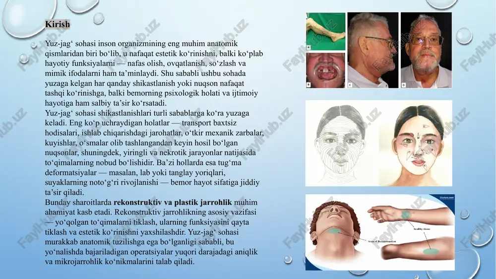 un mikroskop ostida arteriya va vena tomirlari biriktiriladi. agar qon aylanishi muvaffaqiyatli tiklansa, transplantat hayotiyligini saqlab qoladi va yangi joyga moslashadi. to‘qimalarni erkin ko‘chirib o‘tkazishning umumiy tushunchasi erkin ko‘chirish jarayoni boshqa turdagi to‘qima ko‘chirishlardan farq qiladi. masalan, “mahalliy” yoki “ko‘chma” (pedikulyar) flaplarda transplantat donor joy bilan qon tomir aloqasini saqlab turadi. ammo erkin ko‘chirishda bu aloqa to‘liq uziladi, keyinchalik sun’iy ravishda tiklanadi. ushbu usulning afzalliklari quyidagilardan iborat: katta hajmdagi defektlarni yopish imkoniyati; estetik jihatdan tabiiy natija olish; funktsional tiklanish — masalan, chaynash, so‘zlash yoki mimik harakatlarni qayta tiklash; donor joy tanlashda moslashuvchanlik — jarroh zarur to‘qimani tananing eng mos qismidan olish imkoniga ega bo‘ladi. erkin to‘qima transplantatsiyasi murakkab, lekin yuqori natijali operatsiya hisoblanadi. bunda muvaffaqiyat transplantat qon tomirlarini aniq va sifatli biriktirish, operatsiyadan keyingi parvarish, qon aylanishining uzluksizligini ta’minlashga bog‘liq. shunday qilib, to‘qimalarni erkin ko‘chirib o‘tkazish — zamonaviy rekonstruktiv jarrohlikning eng muhim yo‘nalishlaridan biri bo‘lib, u bemorlarning estetik ko‘rinishini va …