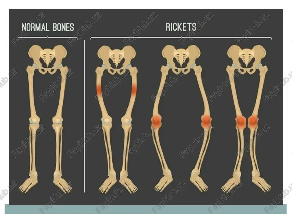 rickets - Page 3