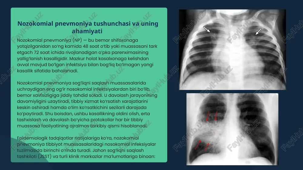 t kokk bo‘lib, traxeya va bronxial naychalarda yiringli yallig‘lanish jarayonlarini keltirib chiqaradi; enterobacter cloacae, escherichia coli, serratia marcescens kabi fakultativ patogenlar ham nozokomial pnevmoniya rivojlanishida ishtirok etishi mumkin. etiologiya va patogenez patogenez mexanizmi nozokomial pnevmoniya rivojlanishida asosiy patogenetik yo‘l — mikroorganizmlarning pastki nafas yo‘llariga tushishi va o‘pka parenximasida yallig‘lanish jarayonini boshlashidir. infeksiya o‘pkaga bir necha asosiy mexanizmlar orqali kiradi: aspiratsiya yo‘li – bemor og‘iz bo‘shlig‘i, halqum yoki oshqozon tarkibidagi mikroblarning aspiratsiya natijasida traxeya va bronxlarga tushishi. bu ayniqsa hushsiz, intubatsiya qilingan yoki reflekslari susaygan bemorlarda kuzatiladi. tibbiy asbob-uskunalar orqali – ventilyator tizimlari, nebulayzerlar, traxeyal naychalar yoki nafas olish yo‘llariga kiritiladigan kateterlar orqali mikroblar bevosita o‘pkaga o‘tadi. sterilizatsiya yetarli bo‘lmaganda bu yo‘l asosiy manba bo‘lib xizmat qiladi. tibbiyot xodimlari orqali – qo‘l gigiyenasi qoidalariga rioya qilinmagan hollarda mikroorganizmlar bemordan bemorga yoki asbob-uskunalar orqali uzatiladi. infeksiya kirgach, patogen mikroorganizmlar o‘pka alveolalarida ko‘payib, neytrofillar, makrofaglar va sitokinlar faollashuvi natijasida yallig‘lanish reaksiyasi yuzaga keladi. …