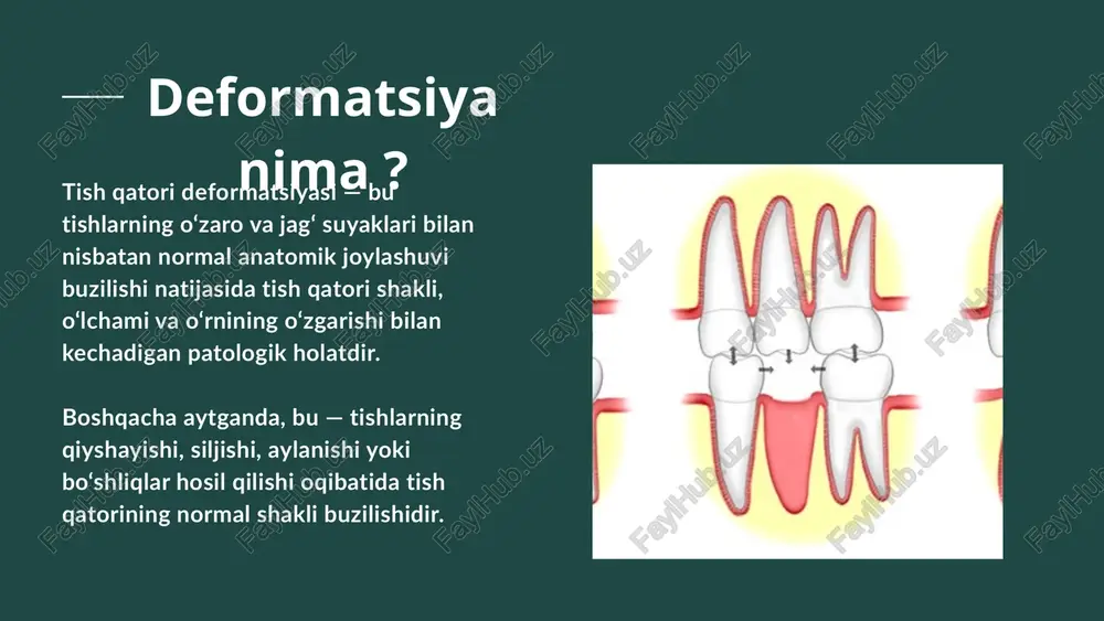 nlovini qiyinlashtiradi . foydalanilgan adabiyotlar : 1) irisaliyev " ortopedik stomatologiya " 2011 2) m.b.bekmetov , f.sh.fayzullayev " ortopedik stomatologiya " - 2001 3) a.d.abduazimov " ortodontiya va tish protezlari " - 2002 eʼtiboringiz uchun rahmat ! image1.jpeg image2.png image3.jpeg image4.jpeg image5.jpeg image6.jpeg image7.jpeg image8.jpeg image9.jpeg image10.jpeg image11.jpeg image12.jpeg image13.jpeg image14.jpeg image15.jpeg image16.jpeg image17.jpeg image18.jpeg image19.jpeg image20.jpeg image21.jpeg image22.jpeg /docprops/thumbnail.jpeg