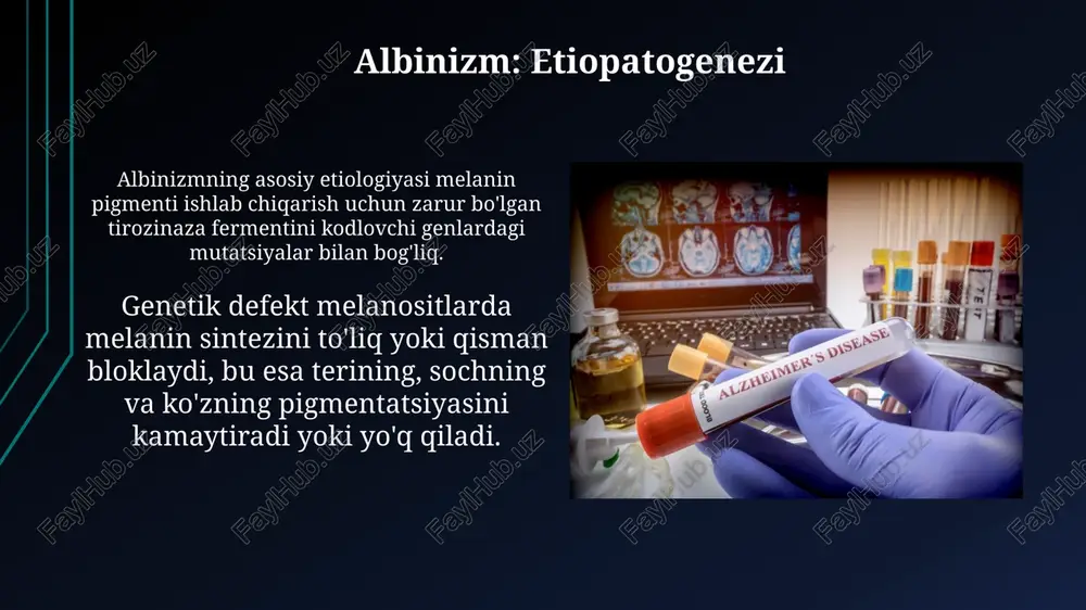 albinizm: etiopatogenezi va klinik ko'rinishi - Page 3
