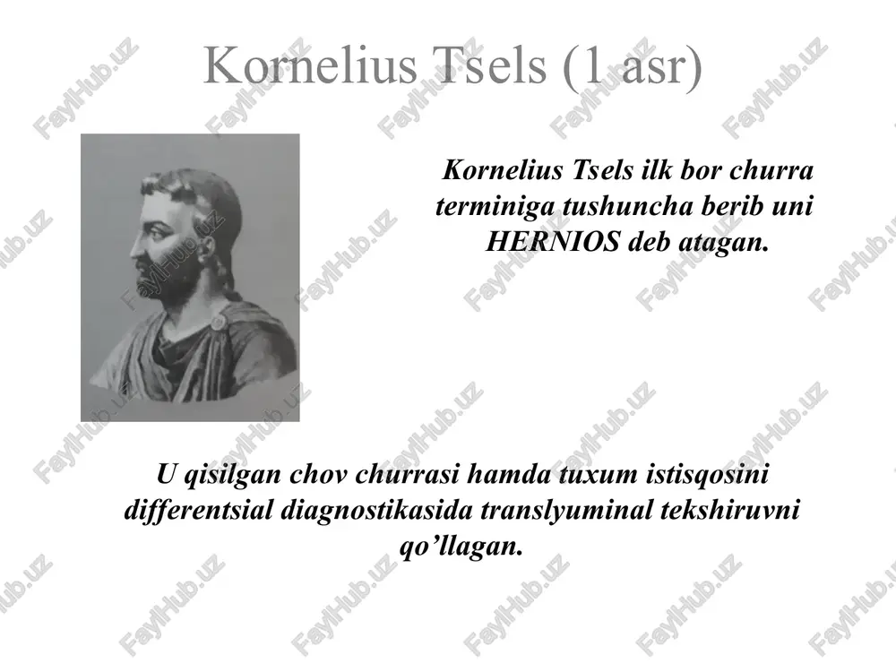 oh kasalliklar bandaj taqishning manfiy tomonlari qorin devori to’qimalarining atrofiyasi churra tarkibidagi a’zo va churra qopi orasida birikmalar hosil bo’lishi churra darvozasi o’lchamlarining kattalashishi teri matseratsiyasi noqulayliklar churralarda jarrohlik amaliyotlarining bosqichlari kesma churra qopini ajratish churra darvozasini kengaytirish churra qopini ochish churra qopini olib tashlash churra darvozasi plastikasi chov churrasidagi kesma kindik churrasidagi kesma va plastikausullari 1- sapejko 2- meyo 3- lekser churra qopini ajratish churra darvozasini kengaytirish churra qopini ochish va churra mahsulotini qorin bo’shlig’iga kiritish churra qopini olib tashlash sirpanuvchi churra bunda churra qopi bilan birga ichki a’zoni kesib qo’yish xavfi yuqori churra darvozasi plastikasi lixtenshteyn operatsiyasi trabukko bo’yicha choklarsiz gernioplastika laparoskopik churra kesish (korbit usuli) da vinci – masofadan jarrohlik amaliyotini bajarish uskunasi da vinci – masofadan jarrohlik amaliyotini bajarish uskunasi da vinci – masofadan jarrohlik amaliyotini bajarish uskunasi da vinci – masofadan jarrohlik amaliyotini bajarish uskunasi umumiy amaliyot shifikorining vazifalari chaqaloqlar gigienasini olib borish - kindik …