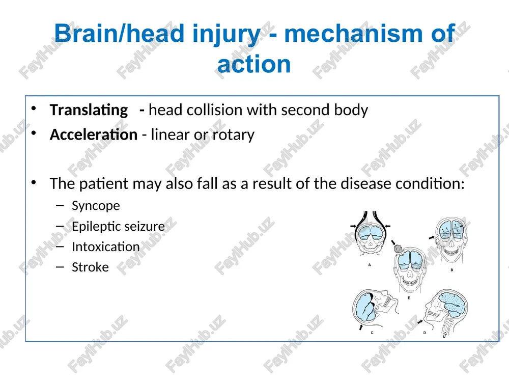 t relative displacement of adjacent parts of the brain with inertia mechanism of mtbi: diffuse axonal injury- dai (or diffuse axonal damage-dad) = functional or structural traumatic damage to the axons of brain white matter, mainly reticulo-cortical pathways loss of consciousness in mtbi - correlates with axonal damage, may also have image of qualitative change of consciousness (disturbance of the outer world perception) dai functional or structural traumatic axonal damage (brain white matter) differential movement of adjacent brain regions during acceleration and deceleration dai is major cause of prolonged coma after tbi, probably due to disruption of ascending reticular connections to cortex, angular forces > oblique/ sagital forces stretched axons = functional impairment , reversible impairment sheared axons = their ascend. and descendent degeneration, permanent damage mtbi - mild traumatic brain injury always comes suddenly duration of symptoms - different (a few seconds to hours) injury mechanism: either by moving …