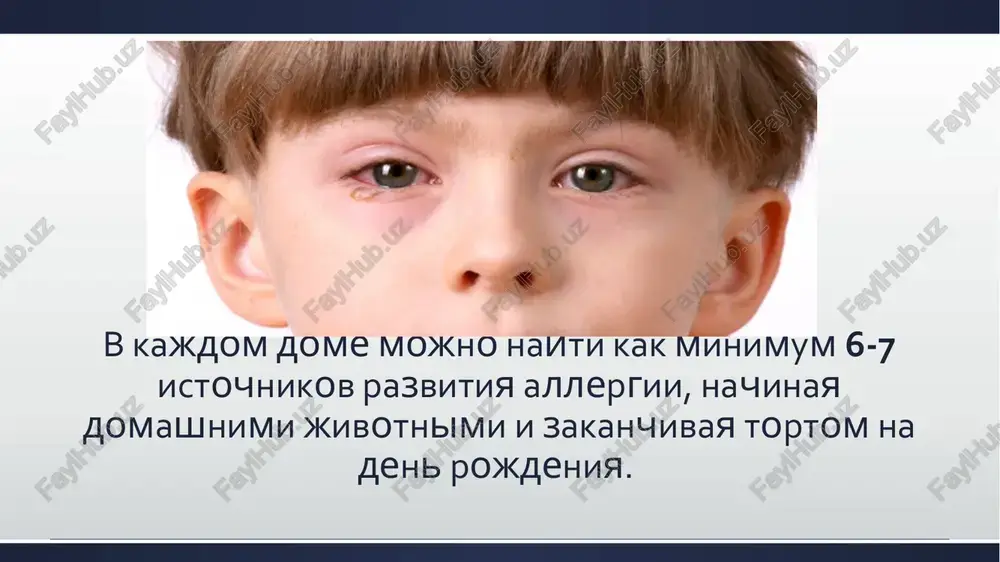 stayushaya dixatelnaya nedostatochnost, umenshenie kolichestva suxix xripov, poyavlenie uchastkov, gde xripi ne vislushivayutsya; iii stadiya - bolnoy teryaet soznanie, dixanie glubokoe, s udlinennim vidoxom, narastaet tsianoz, padaet arterialnoe davlenie, puls stanovitsya nitevidnim. gospitalizatsiya obyazatelna. otek kvinke - angionevroticheskiy otek s rasprostraneniem na koju, podkojnuyu kletchatku, slizistie obolochki. vnachale poyavlyayutsya layushiy kashel, osiplost golosa, zatrudnenie vdoxa i vidoxa, odishka. litso stanovitsya tsianotichnim, zatem blednim. oteki mogut lokalizovatsya na slizistoy obolochke jeludochno-kishechnogo trakta i simulirovat kliniku ostrogo jivota, mogut lokalizovatsya na litse, imitiruya sindrom menera s golovnoy bolyu, toshnotoy, rvotoy, golovokrujeniem. neotlojnaya pomosh: 1) suprastin - 2 ml 2% rastvora ili dimedrol - 2 ml 5% rastvora; 2) prednizolon - 60-90 mg vnutrimishechno ili vnutrivenno; 3) salbutamol, alupent - ingalyatsii; 4) goryachie nojnie vanni; 5) pri nasledstvennom oteke kvinke pokazano perelivanie svejey krovi, svejezamorojennoy plazmi (soderjat ingibitor komponenta komplementa). gospitalizatsiya obyazatelna. krapivnitsa - visipanie na koje zudyashix voldirey, predstavlyayushix soboy otek sosochkovogo …