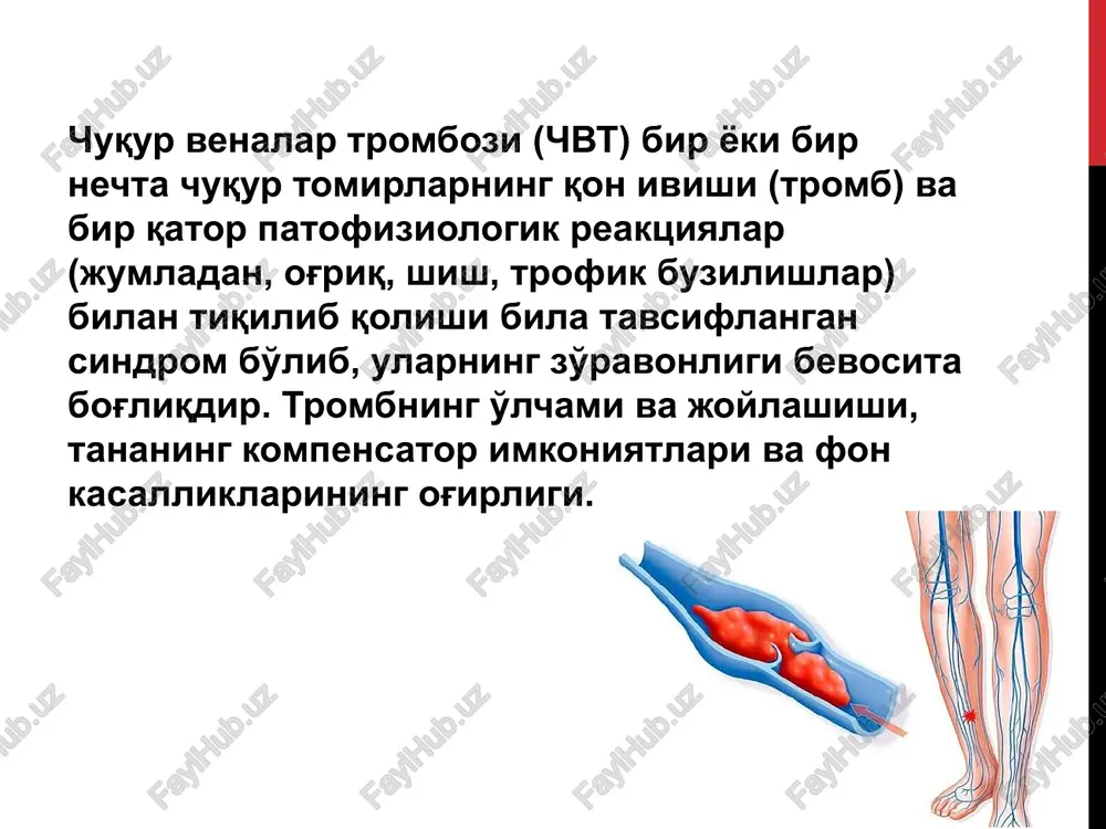 rning kengayishi, tomir ichidagi asboblar (stentlar va boshqalar)). tasnif venoz tromboz turlari a) suzuvchi tromb (tahdidli o'ate) b) okklyuziv v) parietal tromb tasnif 1. mahalliylashtirish bo'yicha: a) pastki ekstremitalarning asosiy tomirlarining trombozi - pastki segment; b) tashqi va umumiy yonbosh venalarining trombozi - o'rta segment; v) pastki kavak vena trombozi - yuqori segment. 2. etiologik omilga ko'ra: birlamchi va tug'ma. 3. klinik kechishiga ko'ra: kompensatsiya bosqichi va dekompensatsiya bosqichi. chvt diagnostikasi majmuasi o'z ichiga oladi klinik ko'rinishni baholash koagulyatsiya va trombotsitlar gemostaz tizimining faollashuv belgilari dinamikasini o'rganish. flebografiya termografiya kompyuter tomografiyasi genetik nuqsonlarni o'rganish rang va energiya qon oqimini xaritalash rejimlari yordamida dupleks va tripleks angioskanerlash 13 klinika kichik yoki o'rtacha og'riq sindromi (ba'zida noaniq lokalizatsiya) chuqur tomirlar tiqilib qolish darajasiga va trombozlangan vena kalibriga qarab taqsimlangan oyoq-qo'l segmentining shishishi (odatda zich). oyoq-qo'l terisining siyanozi teri venoz naqshini kuchaytirish (kasallik boshlanganidan 5-7 kun davomida) oyoq-qo'llarining teri haroratining oshishi buzoq mushaklarining …