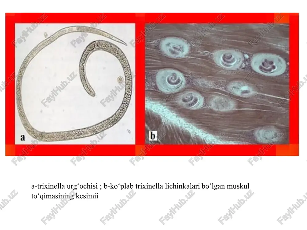 igik tashxisi qonda mikrofilyariyalarning topilishidir. loa-loa (loa-loa). g‘arbiy afrika mamlakatlarida – loa-loa degan nematoda uchraydi. ularni chaqiradigan kasallik loaoz deb ataladi. voyaga yetgan parazitlar teri osti kletchatkalarida va seroz bo‘shliqlarida yashaydi. ba’zan ko‘zga kirib, konyuktiva ostida joylashadi. ulardan tug‘iladigan lichinkalar o‘pka kapillyarlarida yig‘iladi, bir necha kundan so‘ng periferik qonga chiqadi. lichinkalar kunduzi periferik qonda yashasa, kechalari ichki organ qon tomirlariga o‘tib oladi. parazitlarning asosiy xo‘jayini odam, oraliq xo‘jayini chrysops avlodiga kiruvchi so‘nalardir. parazitologik tashxisi mikrofilyariyalarni qonda aniqlashdan iborat. ovogelmintoskopiya ovogelmintoskopiya - parazit gijjalarning (gelmintlarning) tuxumlariii aniqlash. gelmintoskopiya deyilganda gelmintlarning tana qismlarini yoki o‘zlarini aniqlash tushuniladi. gelmintoskopiya va ovogelmintoskopiya gelmintozlarga tashxis qo‘yish uchun zarur. bundan birinchi maqsad - davolash, ikkinchisi- gelmintozlarni oldini olishdir (profilaktikasi). «degelmintizatsiya” - bu gelmintlardan faqtgina saqlanish emas, balki ularga qarshi faol holda kurash, shuningdek gelmintlar bilan kurashibgina qolmay, balki ularning hamma taraqqiyot davrlariga qarshi kurash olib borishdir. ”devastatsiya” esa parazitning ma’lum bir hududda yoki umuman tur sifatida …