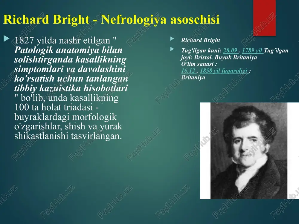 ir glomerulonefrit . patogenez gn ning immun tabiati shubhasizdir genetik moyillik antigen (ekzogen yoki endogen) ta'sirida yuzaga keladi. mikrotromboz va mikronekroz rivojlanishi bilan mikrosirkulyatsiya buzilishlarini qo'zg'atadigan immun komplekslarning shakllanishi bilan immunitet reaktsiyasi shakllanadi. bunga javoban o'ziga xos bo'lmagan yallig'lanish rivojlanadi (immun tizimi kapillyar bazal membrana tropik bo'lgan, uning yuzasida mahkamlangan antikorlarni ishlab chiqaradi). patogenez 2 membrananing shikastlanishi sodir bo'ladi va uning antijeni tanaga begona bo'ladi avtoantikorlar ishlab chiqariladi, ular ham bazal membranada o'rnatiladi komplement avtoantigen-otoantikor lokalizatsiyasi hududida membranada joylashadi neytrofillar bazal membranaga o'tadi neytrofillar vayron bo'lganda, membrana shikastlanishini oshiradigan lizosomal fermentlar chiqariladi. patogenez 3 shu bilan birga, koagulyatsion tizimning faollashishi sodir bo'ladi, bu koagulyatsion faollikni kuchaytiradi va antigen va antikor joylashgan hududda fibrinning cho'kishi. membrananing shikastlanish joyida o'rnatilgan trombotsitlar yallig'lanish jarayonini kuchaytiradigan vazoaktiv moddalarni chiqaradi. jarayonning surunkali kechishi kapillyar bazal membrana antijenlariga avtoantikorlarning doimiy ishlab chiqarilishi bilan bog'liq. patogenez 4 shunday qilib, cgn ning rivojlanishi immun asosga ega. to'lqinlar shaklida …
