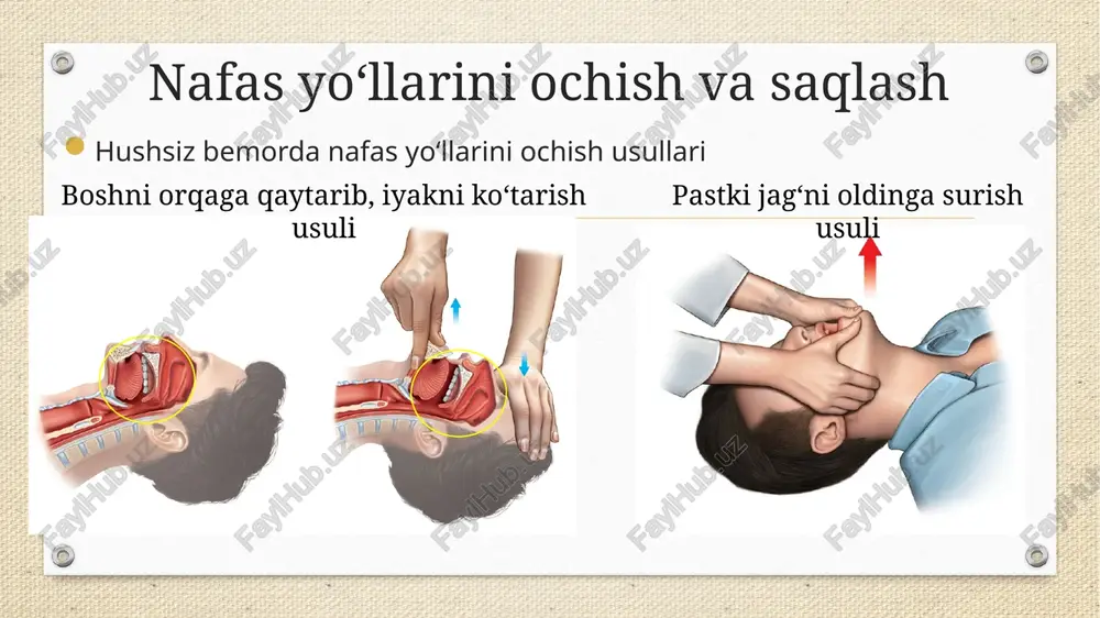 g‘ri ishlatilsa, karbonat angidrid yig‘ilib, nafas qisishiga olib keladi 13 bronxodilatatorlar ko‘rsatmalar qo‘llash mumkin bo‘lmagan holatlar bronxial astma surunkali obstruktiv o‘pka kasalligining zo‘rayishi hush yo‘qolishi sababli bemorning hamkorlik qilmasligi preparatga allergiya mavjudligi tarkibi ko‘p uchraydigan nojo‘ya ta’sirlari salbutamol (albuterol) taxikardiya bosh og‘rig‘i tremor (titroq), mushak tortishishlari gipokaliyemiya (kaliy yetishmovchiligi) 14 kengaytirilgan (ilg‘or) havo yo‘llari supraglottal havo yo‘lini ta’minlovchi vositalar endotraxeal intubatsiya turlari larengeal niqob (lma) i-gel larengeal trubka (lt) laringoskop yordamida intubatsiya video laringoskop yordamida intubatsiya (glidescope, pentax airwayscope) ko‘rsatmalar yurak-o‘pka reanimatsiyasida (cpr) havo yo‘llarini ta’minlash yurak-o‘pka reanimatsiyasida (cpr) havo yo‘llarini ta’minlash nojo‘ya ta’sirlari ovqat massasi bilan aspiratsiya trubkaning siljishi qizilo‘ngachga intubatsiya og‘iz-halqum, ovoz bog’lamlari, qizilo‘ngach va traxeyaga shikast yetkazilishi tishlarning shikastlanishi giperventilya o‘ng bronxga intubatsiya bo‘lib qolishi 15 16 nafas yo‘llarining obstruksiyasi nafas yo‘llari obstruksiyasining klinik belgilari umumiy klinik belgilar isitma yoki nafas yo‘llari bilan bog‘liq shikoyatlarsiz to‘satdan paydo bo‘lgan nafas qisilishi yo‘tal, ko‘ngil aynishi, stridor, xirillash og‘ir darajadagi …