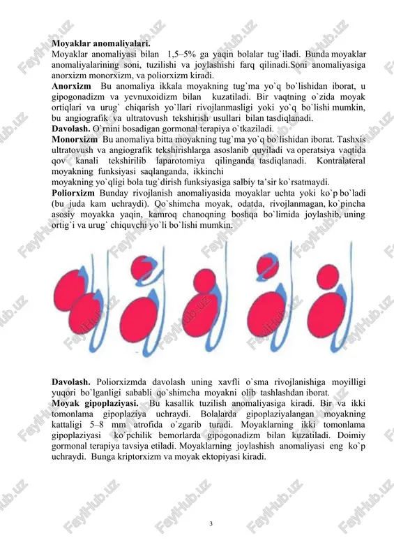 hiqishi to`g`risida ko`pgina nazariyalar mavjud. ularning orasida ko`pchilik tomonidan tan olingani quyidagilardir: 55-rasm. urug`don joylashuvidagi anomaliyalar. 1. mexanik nazariya. urug`donning ushlanib qolishi uning rivojlanishidagi jarayon va atrof to`qimalar bilan bo`lgan o`zaro aloqaning buzilishiga bokliq. uning yorg`oqqa tushish yo`li chandiqlar bilan bekilib qolishi mumkin. 2. endokrin nazariya. bu nazariyaga binoan, gipofiz stimulyatsiyasiga urug`donlar to`g`ri javob bera olmaydi. 3. genetik nazariya. ayrim olimlar tomonidan genetik omillarning kriptorxizmning kelib chiqishidagi ahamiyati tan olingan. yuqoridagilardan kelib chiqib shuni aytish mumkinki, kriptorxizm polietiologik xususiyatga ega. klinikasi. bir va ikki tomonlama kriptorxizm farq qilinadi. bir tomonlama kriptorxizmda tegishli tomonning yorg`og`i yetarli ravishda rivojlanmagan va uning ichida uruvdon qo`lga unnamaydi. ikki tomonlama kriptorxizmda esa yorg`oqning ikki tarafi ham rivojlanmagan. urug`don (urug`donlar) chov kanalida yoki chov kanali tashqi teshigi to`g`risida qo`lga unnashi mumkin. agar urug`donlar qorin sohasida joylashgan bo`lsa, palpatsiyada umuman hech narsa sezilmaydi. chov kanalida joylashgan urug`don kam-harakat bo`lib, ozgina og`rishi mumkin bo`lgan hosila tariqasida qo`lga unnaydi. …