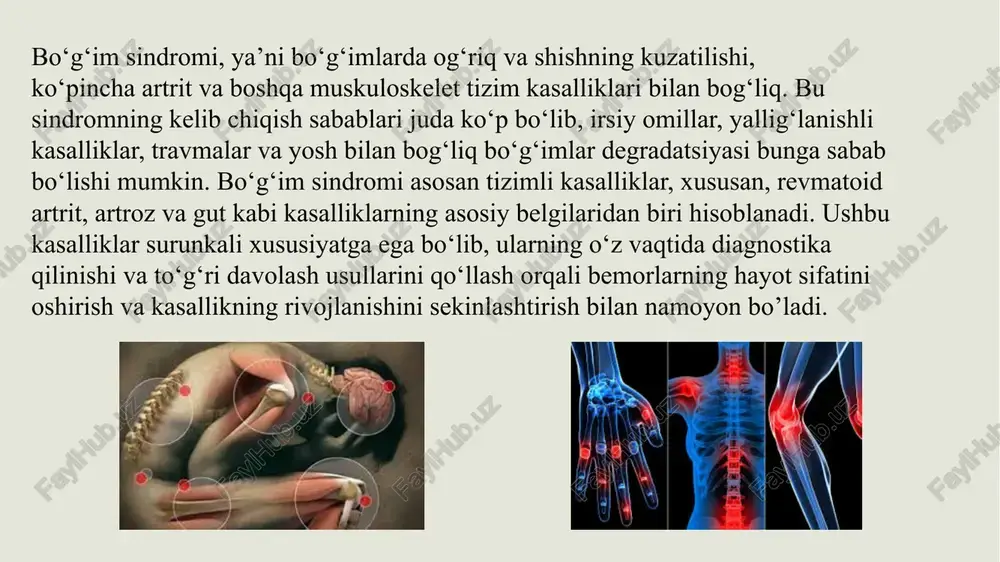 keladigan sabablar quyidagilardan iborat: irsiy omil; bo‘g‘imlar jarohatlari (chandiqlar, chiqishlar); tez-tez jismoniy yuklamalar; organizm intoksikatsiyasi; endokrin buzilishlarga olib keladigan kasalliklar (qandli diabet, qalqonsimon bez faoliyatining buzilishi); bo‘g‘imlar displaziyasi; ortiqcha tana vazni; boldir venalarining varikoz kengayishi. osteoartroz belgilari osteoartroz belgilari quyidagilarni o‘z ichiga oladi: harakat va jismoniy yuklamalar paytida kuchayadigan bo‘g‘imlardagi og‘riq; bo‘g‘im tog‘ayi ostidagi suyak to‘qimasining zichlashishi; zararlangan oyoqni qisqartirish; kasallik zo‘rayib borishi bilan kuchayadigan uyqudan keyin harakatlanishdagi qiyinchiliklar; harakat paytida bo‘g‘imlarda g‘ichirlash va qirsillash. diagnostika osteoartrozni tashxislash uchun ortoped shifokor quyidagi tekshiruvlarni buyurishi mumkin: bo'g'imlarni mrt qilish qo'shimchalarning rentgeni umumiy qon tekshiruvi bo'g'im punksiyasi osteoartrozni davolash yallig‘lanish va og‘riqni yo‘qotish uchun. analgetiklar: og‘riqni yengillashtirish uchun. fizioterapiya: mushaklarning harakatchanligini yaxshilash va mustahkamlash uchun. ozonoterapiya: yallig‘lanishni kamaytirish uchun. davolash massaj: sirkulyatsiyani yaxshilash va zo‘riqishni yo‘qotish uchun. bo‘g‘imlarni cho‘zish: bosimni kamaytirish va harakatchanlikni yaxshilash uchun. bo‘g‘imlarni ko‘chirib o‘tkazish: shikastlangan bo‘g‘imni sun’iy bo‘g‘imga almashtirish. suyaklar rekonstruksiyasi: suyak shakli va funksiyasini tiklash. podagra artriti …