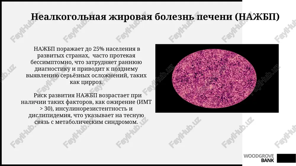 vlyaetsya jeltuxoy, lixoradkoy i bolevim sindromom v pravom podrebere, lechenie vklyuchaet antibiotiki i drenaj jelchevivodyashix putey. zabolevaniya jelchevivodyashix putey chasto privodyat k obrazovaniyu jelchnix kamney, priblizitelno u 10-20% naseleniya razvivayutsya simptomi xoletsistita, trebuyushie meditsinskoy pomoshi. woodgrove bank anatomiya i fiziologiya pecheni gepatotsiti, osnovnie kletki pecheni, sostavlyayut okolo 80% eyo massi i vipolnyayut bolee 500 funktsiy, vklyuchaya metabolizm belkov, uglevodov i lipidov, detoksikatsiyu i sintez jelchi. pechen poluchaet dvoynoe krovosnabjenie: 75% ot vorotnoy veni, nesushey krov iz pishevaritelnogo trakta, i 25% ot pechyonochnoy arterii, obogashennoy kislorodom, obespechivaya intensivniy metabolizm. woodgrove bank diagnostika zabolevaniy pecheni uzi pecheni pozvolyaet vizualizirovat razmeri, strukturu pecheni, viyavit nalichie kist, opuxoley i drugix patologicheskix obrazovaniy razmerom bolee 5 mm. pri bioximicheskom analize krovi povishenie urovnya alt i ast bolee chem v 2-3 raza ot normi ukazivaet na povrejdenie gepatotsitov, trebuyushee dalneyshego obsledovaniya. woodgrove bank virusnie gepatiti effektivnost lecheniya xronicheskix virusnix gepatitov dostigaet 95% pri ispolzovanii sovremennix protivovirusnix …
