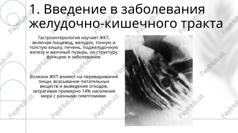 ostika tseliakii vklyuchaet serologicheskie testi, takie kak opredelenie antitel k tkanevoy transglutaminaze (anti-ttg iga) i endomiziyu (ema), a takje biopsiyu tonkoy kishki. 11.divertikulyarnaya bolezn divertikulyarnaya bolezn chasto ostaetsya bessimptomnoy; okolo 80% lyudey s divertikulami ne ispitivayut nikakix simptomov na protyajenii vsey jizni. divertikulit, vospalenie divertikulov, proyavlyaetsya ostroy bolyu v jivote, chasto v levoy nijney chasti, soprovojdaemoy lixoradkoy i leykotsitozom. 12.ostrie kishechnie infektsii ostrie kishechnie infektsii vklyuchayut rotavirusnuyu infektsiyu, vizivayushuyu do 50% sluchaev diarei u detey do 5 let, xarakterizuyushuyusya vodyanistim stulom i rvotoy. salmonellez, vizvanniy bakteriyami salmonella, chasto voznikaet iz-za upotrebleniya zarajennoy pishi, osobenno yaits i myasa, i proyavlyaetsya cherez 12-72 chasa. 13.xronicheskie zabolevaniya pecheni xronicheskie zabolevaniya pecheni vklyuchayut tsirroz, xarakterizuyushiysya fibrozom i obrazovaniem uzlov, narushayushix strukturu pecheni i privodyashix k portalnoy gipertenzii u 40% patsientov. nealkogolnaya jirovaya bolezn pecheni (najbp), porajayushaya do 25% naseleniya, mojet progressirovat v nealkogolniy steatogepatit (nasg), uvelichivaya risk razvitiya tsirroza na 15-20%. 14.pankreatit ostriy pankreatit …