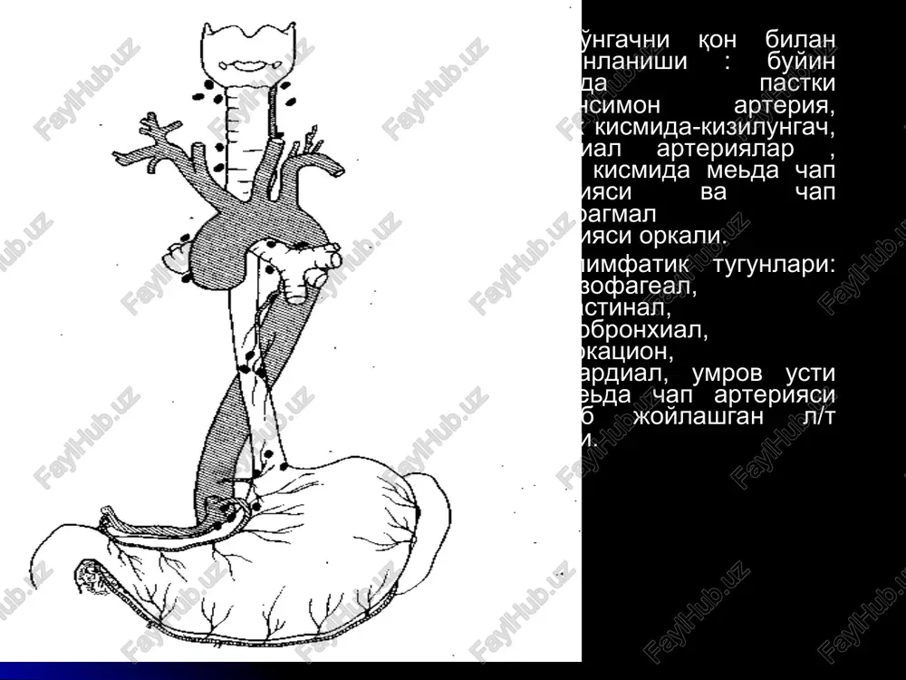 is torayishi devorining qotishi va peristaltikaning yo`qolib ketishi yumshoq, engil qonaydigan, oqimtir yoki to`q qizil rangdagi hosila notekis, qonaydigan tubli, atroflari qattiq qora-kulrang karash bilan koplangan yara qattiq, oqimtir bo`shlig`ini toraytiradigan yoki qimirlamaydigan hosila ezofagoskopiya chandiqli o`zgarishlar axalaziya divertikula o`tkir ezofagitlar taqqoslovchi tashxisot differentsial diagnostikasi xavfsiz usmalar bilan kardiospazm qizilo'ngach banal yarasi surunkali ezofagit qizilo'ngach eroziyalari sklerozlovchi mediastinit qizilo'ngachning kuyishdan keyingi torayishi . kiziulungach chandikli stenozi . axalaziya- asosan esh va urta eshda uchraydi. anamnezi uzok vakt, vakti-vakti bilan bemor axvoli yaxshilanib turadi. disfagiya asosan xayajonlanish, asabiylashishdan keyin kuchayadi. disfagiya doimiy emas, bemorlar ovkat kabul kilganda, xarakat kilishganda ovkat utishi yaxshilanishi mumkin. kardiospazmda ovkatdan oldin spazmolitiklar, atropinizatsiyadan keyin ovkat utishi yaxshilanadi. kizilungach chandikli torayishlari- termik va ximik kuyishlardan keyin paydo buladi. anamnezi uzok vakt, disfagiya doimiy buladi. rentgenda simmetrik toraygan joylari tulkinsimon buladi, toraygan kismi kup joyni egallaydi. chandikli torayishlardan keyin rak kelib chikadi. kizilungach yaralari- peptik yaralar kuzatiladi, kizilungachni …