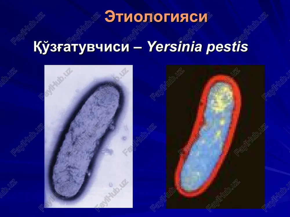 takix kak koshki, surki. (c) vtorichno-ochagovie formi chumi (vtorichno-generalizovannaya i drugie) razvivayutsya obichno pri otsutstvii lecheniya, zapozdalom ili nepravilnom lechenii (e). vtorichno-ochagovaya pnevmonicheskaya chuma (i drugie vtorichno-ochagovie formi) yavlyaetsya po suti oslojneniem pervichnix form i razvivaetsya v rezultate gematogennoy disseminatsii vozbuditelya pri nepravilnom ili zapozdalom lechenii. vtorichnie sluchai bubonnoy, ili generalizovannoy formi chumi mogut razvitsya pri peredachi infektsii ot cheloveka cheloveku pri kontakte s mokrotoy videleniyami iz yazvi ili bubona (d); no chashe, zakonomerno, razvivayutsya vtorichnie sluchai pnevmonicheskoy chumi (vozdushno-kapelniy put peredachi) (s), chto yavlyaetsya pokazatelem perexoda chumi iz sporadicheskoy v epidemicheskuyu zabolevaemost. o'latning har bir yuqish yo'liga ma'lum bir klinik shakli mos keladi yuqish yo'li klinik shakli transmissiv bubon yoki teri-bubon shakli havo-tomchi o'pka shakli alimentar faringeal (anginoz) yoki ichak shakli kontakt-maishiy bubon yoki teri-bubon shakli o'latning klinik manzarasi bubon shakli bubon – kattalashgan limfa tuguni. u yakka holda kattalashgan, qattiq, keskin og'riqli, harakatsiz, ustidagi teri qizargan va mahalliy …