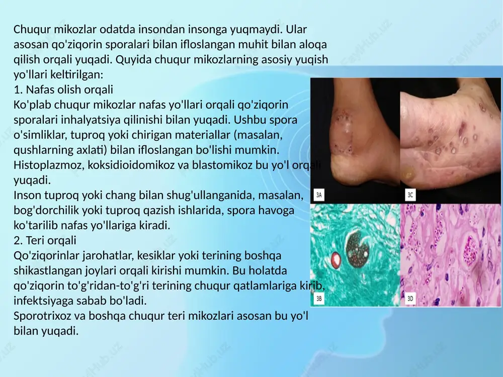 omatlar: isitma charchoq va zaiflik ozish va ishtahaning yo'qolishi maxsus mikozlar klinikasi: histoplazmoz: asosan o'pka simptomlari, lekin dissiminasiyalangan shakllari jigar, taloq va suyak iligiga ta'sir qilishi mumkin. blastomikoz: o'pka, teri va suyaklarni zararlashi bilan namoyon bo'ladi. koksidioidomikoz: nafas olish simptomlari, o'pka kasalliklari va ba'zan suyaklar, miya va teriga ta'sir ko'rsatadi. kandidiyoz: qo'ziqorin ichki organlarga (masalan, yurak, buyrak) zararlashganda, sepsis va boshqa og'ir holatlar rivojlanishi mumkin. diagnostika: mikroskopik tekshirish va madaniyati qo'ziqorin antigenlari uchun qon va balg'am tahlillari rentgen va kompyuter tomografiyasi (infeksiya joylashgan joylarni aniqlash uchun) erta tashxis va davolash og'ir asoratlardan qochishga yordam beradi. chuqur mikozlarning davolash usullari infeksiyaning turi, joylashuvi va bemorning umumiy sog'lig'iga qarab farqlanadi. asosiy davolash antifungal preparatlar bilan amalga oshiriladi, lekin ba'zi holatlarda jarrohlik aralashuvi ham talab qilinishi mumkin. asosiy davolash usullari: 1. antifungal dori vositalari amfoterisin b: juda kuchli antifungal preparat bo'lib, ko'plab chuqur mikozlar uchun qo'llaniladi. u vena ichiga yuboriladi va og'ir holatlarda …