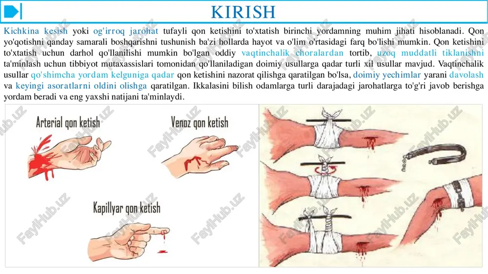 an foydalangan ma’qul. ❖ qo'l bilan bosib turish tomirlar yuzaki joylashganda bajarilishi mumkin yoki uni jgut qo'yish uchun tayyorgarlik vaqtida qo'llasa bo'ladi, chunki qo'l bilan bosib turish vaqti 15-20 daqiqadan oshmaydi. bundan tashqari, bosib turilganda atrofdagi nerv yo'llari, to'qimalar ezilib, qattiq og'riqqa sabab bo'ladi va qaytarib bo'lmaydigan asoratlar vujudga keladi. qon ketishini vaqtincha to’xtatish usullari e. qon ketishni to'xtatish maksimal bukish yoki bo'g'imlarni o'ta cho'zish bilan bajarilishi mumkin. masalan, taqim arteriyasi yaralanganda tizza bo'g'imini, yelka arteriyasi shikastlanganda tirsak bo'g'imini, son arteriyasi yaralansa, chov sohasida chanoq- son bo'g'imini maksimal bukish yaxshi yordam berishi mumkin. f. qon ketayotgan joydan yuqorisiga jgut yoki boshqa biror bog'lam qo'yish bilan bajariladi. unda qattiq tortilgan jgut yoki bog'lam to'qimali burama tomirni suyakka qisib turadi. qon ketishini batamom to’xtatish usullari qon ketishini mexanik, termik, ximiyaviy va biologik usullar bilan batamom to'xtatish mumkin. tashqi qon ketganda agar shikastlangan tomir ko'rinmasa, jarohat xirurgik yo'l bilan kengaytiriladi, qorin yoki ko'krak …
