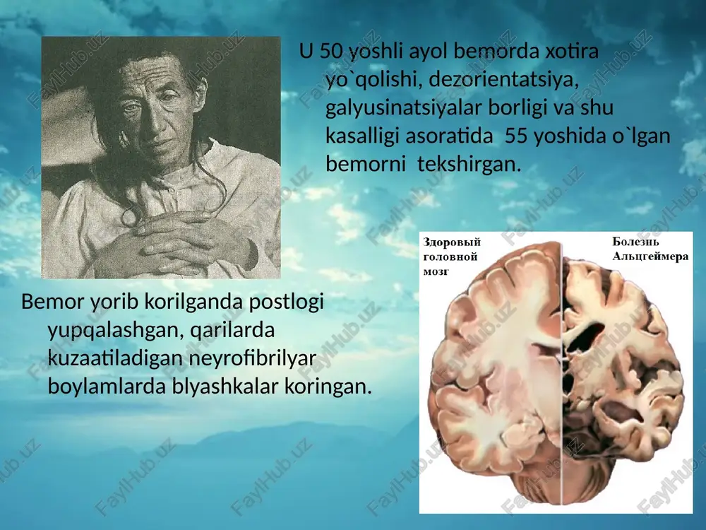 qiynaladi. rasm chizganda, yozganda, kiyim kiyayotganda va boshqa nozik matorika bilan bajariladigan ishlarda qiynaladi. o`rta darajadagi demensiya so`zlashganda so`zlarni chalkashtiradi. bu unitgan so`zlarni o`rniga boshqa so`zlrni qo`llaganda kuzatiladi. o`qish va yozish qobiliyati yo`qolib boradi. xotira yo`qolishi kuchyib boradi. yaqin qarindoshlarini tanimaydi. qo`zg`aluvchanlik, emotsional labillik va yig`lash, spontan agressiya, yordam berayotganda qarshilik ko`rsatish. og`ir demensiya kasallikning oxirgi bosqichida bemor to`liq boshqalarning yordamiga muxtoj bo`ladi. verbal muloqot yo`qolgan bo`lsa ham bemor emotsional holatlarni tushunida va javob qaytaradi. bemor mushak massasi kamayadi, yurishga qiynaladi, yotoqdan tura olmaydi, keyinchalik o`zi ovqatlana olmaydi. o`lim ikkilamchi faktorda kelib chiqadi yotoq yara yoki pnevmoniya. asorati bu kasallikda ko`pincha infeksiya yuqishiga moyil bo`ladi va pnevmoniyaga chalinadi, hamda to`yib ovqat yemaslik kuzatiladi. diagnostika bu kasallikni erta bosqichlaarida aniqlash muhim ahamiyatga ega. buni amalga oshirishda yaqin qarindoshlarning uydagi qari insonlarni kuzatib borishi hamda ularni tekshiruvlarda birga bo`lishi kerak. agar yuqorida sanab o`tilgan simptomlar kuzatilsa mutaxassis bilan maslahatlashish kerak. bosh miy …