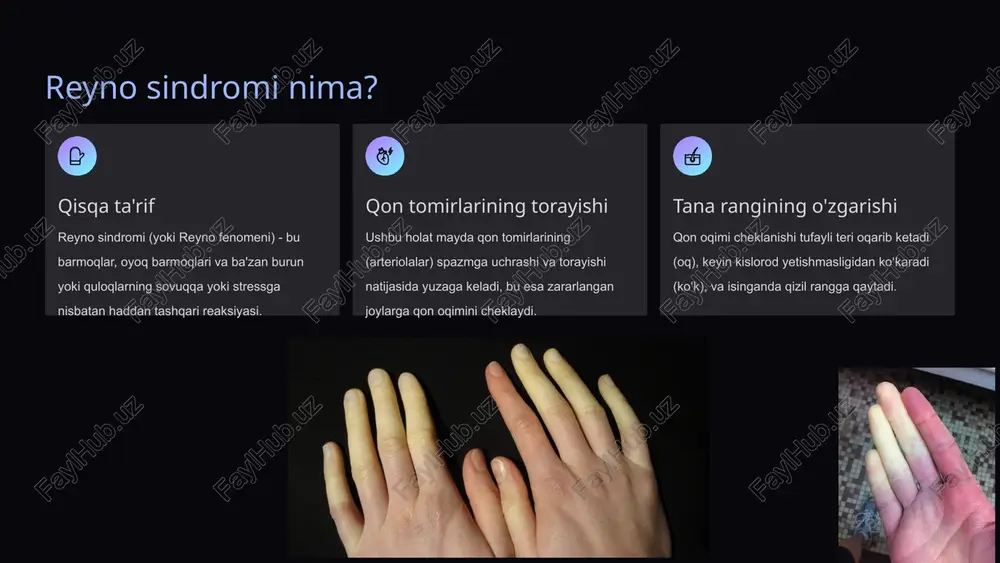 ab turish. bosh, oyoq va qo‘llarni yaxshi izolyatsiyalash uchun shlyapa, qo'lqop va qalin paypoqlardan foydalaning, hatto uy ichida ham. stressni kamaytirish hissiy stress reyno hujumini keltirib chiqarishi mumkin. yoga, meditatsiya yoki chuqur nafas olish mashqlari kabi usullar orqali stressni boshqarishni o'rganing. triggerlardan saqlanish kofein va nikotin kabi qon tomirlarini toraytiruvchi moddalardan, shuningdek, uzoq muddat sovuq havoda turishdan qoching. hujum boshlanganda, tezda iliq joyga o'ting va qo'llaringizni iliq suvga soling yoki ularni tez-tez ishqalang. 7 asoratlari: nimadan ehtiyot bo'lish kerak? ko‘pchilik holatlarda reyno sindromi jiddiy asoratlarni keltirib chiqarmaydi (ayniqsa, birlamchi turi). biroq, ikkilamchi reyno fenomeni xavfliroq bo'lishi mumkin. teri yaralari va infeksiyalar qon oqimining doimiy ravishda kamayishi barmoqlarning uchida og'riqli yaralar (trofik yaralar) paydo bo'lishiga olib kelishi mumkin. bu yaralar infeksiyalanishi mumkin. gangrena (juda kamdan-kam) juda og'ir va nazoratsiz holatlarda, qon aylanishining uzoq muddatli to'xtashi to'qimalarning o'lishiga (gangrena) olib kelishi mumkin. bu vaziyat barmoqni amputatsiya qilishni talab qilishi mumkin. asosiy kasallikning …