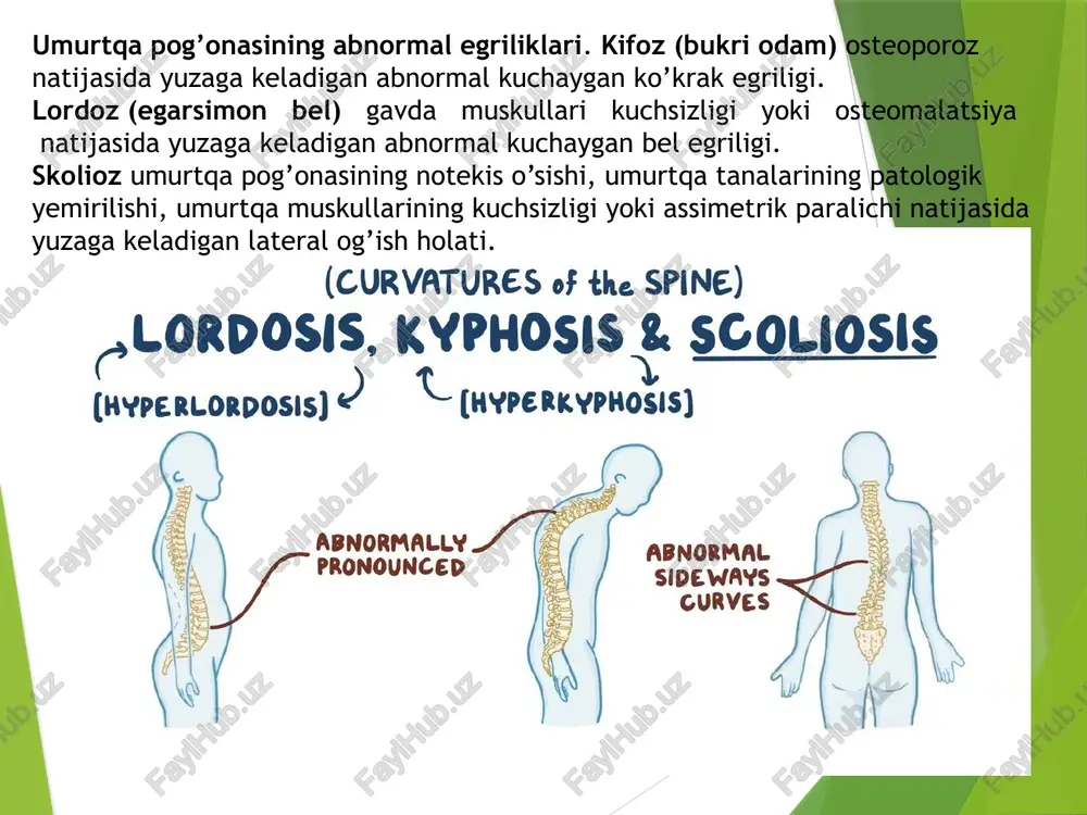 nlaydi va shok absorber (yutuvchi) vazifasini bajaradi ■ periferik qismi qon bilan ta’minlangan, qolgan qismi qon tomir bilan ta’minlanmagan (avaskular). nucleus pulposus (dildiroq yadro) ■ umurtqalararo diskning markaziy qismida joylashgan bo’lib, embrional notoxordning qoldig’i hisoblanadi. ■ mukoid modda ichiga botib kirgan retikulyar va kollagen tolalardan tashkil topgan. ■ annulus fibrosus orqali bo’rtib yoki churra bo’lib chiqishi mumkin. shuning uchun orqa miya nerv ildizlariga salbiy ta’sir qiladi. ■ bosimni tenglashtirish orqali shok yutuvchi vazifasini bajaradi. annulus fibrosus (fibroz halqa) ■ fibroz –to’g’ayli va fibroz to’qimaning konsentrik qavatlaridan iborat. ■ umurtqa pog’onasini o’zaro bog’laydi, dildiroq yadroni (nucleus pulposus) tutib turadi va cheklangan miqdorda harakatni ta’minlaydi. ■ shokni yutuvchi vazifasini bajaradi. disk churrasi bu dildiroq yadro (nucleus pulposus) ni fibroz halqa (annulus fibrosus) orqali umurtqalararo teshikka yoki umurtqa kanaliga bo’rtib chiqishiga aytiladi. natijada spinal nerv ildizlari eziladi. bu ko’pincha fibroz halqaning orqa pastga yo’nalgan boylam (ligamentum longitudinalis posterior) bilan mustahkamlanmagan qismida, orqa lateral …
