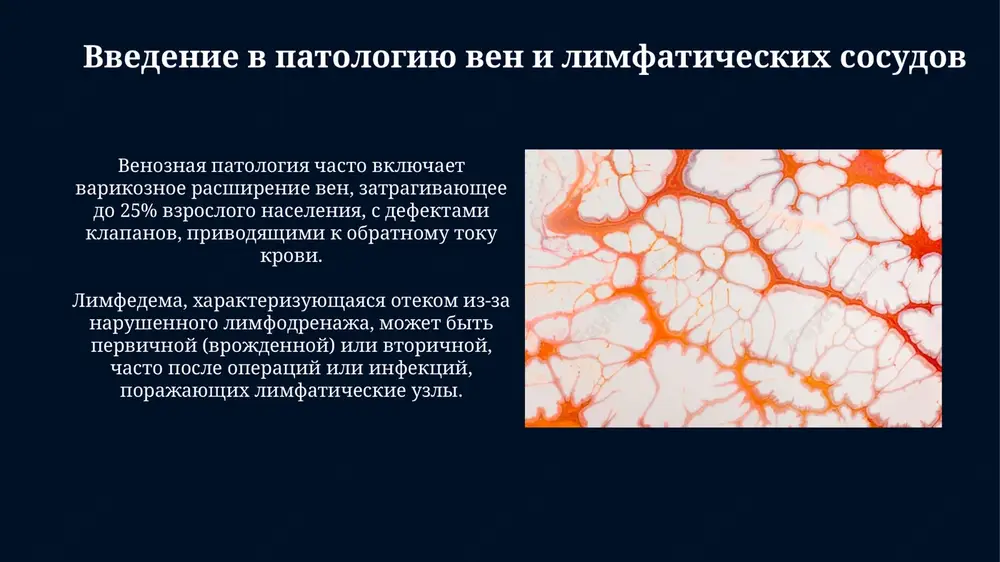 ntikoagulyatsii ili texnicheskix pogreshnostey, privodyashix k snijeniyu krovotoka i ishemii distalnee proteza. infektsiya proteza, osobenno vizvannaya staphylococcus aureus, yavlyaetsya sereznim pozdnim oslojneniem (1-6%), trebuyushim agressivnogo lecheniya, vklyuchaya udalenie proteza i dlitelnuyu antibiotikoterapiyu. stenoz i restenoz posle angioplastiki: patomorfologicheskie mexanizmi restenoz posle angioplastiki vklyuchaet neointimalnuyu giperplaziyu, gde gladkomishechnie kletki migriruyut i proliferiruyut, sinteziruya vnekletochniy matriks, sujaya prosvet sosuda do 50% v techenie 3-6 mesyatsev. stenoz chasto voznikaet iz-za ateroskleroticheskoy bolezni, privodyashey k sujeniyu prosveta sosuda, a patomorfologicheskie mexanizmi vklyuchayut nakoplenie lipidov i vospalitelnix kletok v stenke arterii. tromboz stenta: prichini i posledstviya tromboz stenta voznikaet iz-za povrejdeniya endoteliya sosuda vo vremya implantatsii, chto aktiviruet trombotsiti i faktori svertivaniya, privodya k obrazovaniyu tromba v techenie 30 dney. nedostatochnaya antitrombotsitarnaya terapiya, osobenno klopidogrelem ili aspirinom, posle ustanovki stenta, uvelichivaet risk tromboza na 2-3% v techenie pervogo goda posle protseduri. infektsionnie oslojneniya sosudistix vmeshatelstv infektsii protezirovannix sosudov, naprimer, s ispolzovaniem dakrona, mogut bit vizvani …